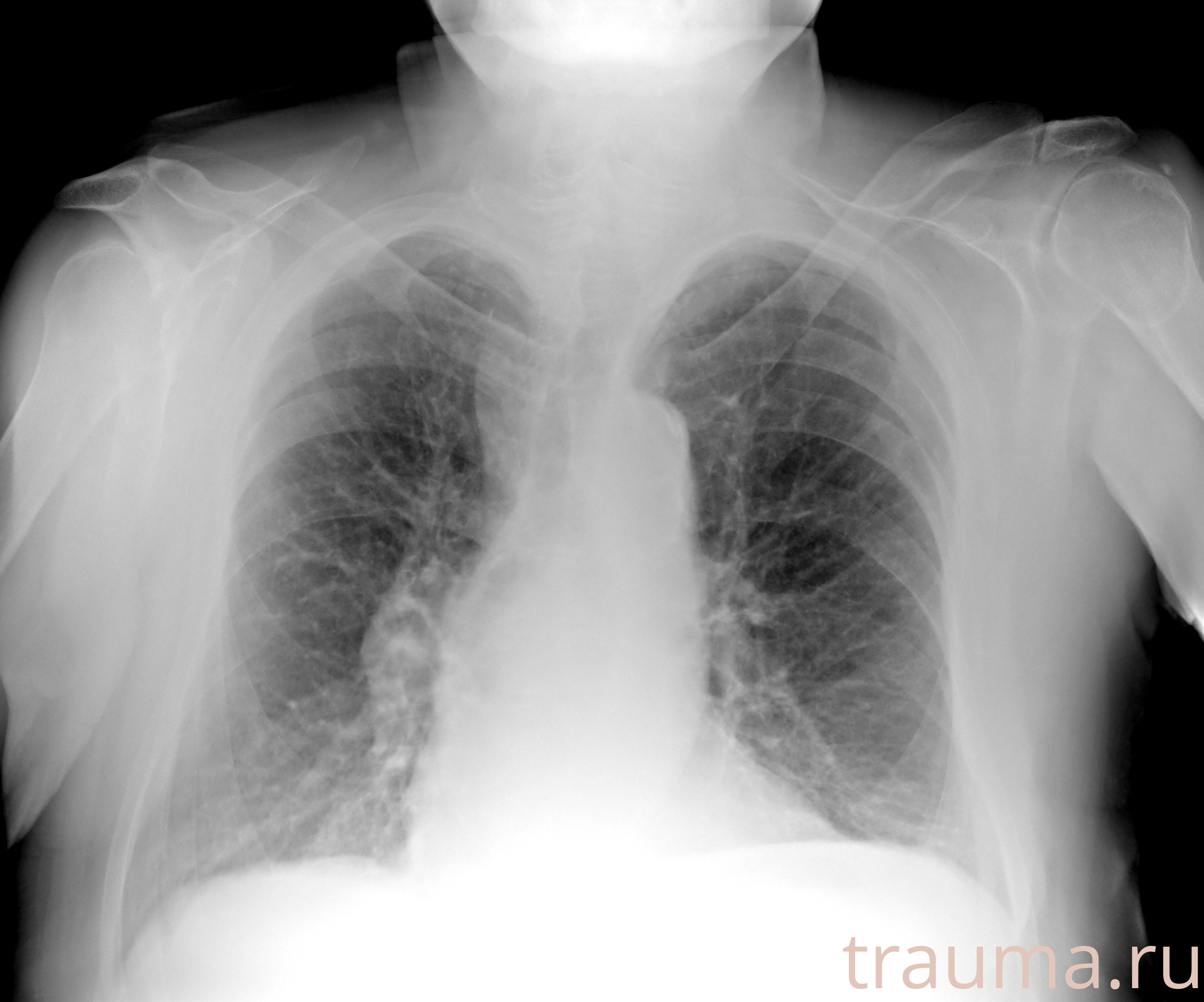 Рентген на дому: по вашему адресу приезжает врач-рентгенолог, травматолог-ортопед с мобильным рентгеновским аппаратом, проводит диагностику травмы или заболевания, делает необходимые рентгенограммы, дает рекомендации по дальнейшему лечению. Получить качественные снимки в домашних условиях возможно благодаря уникальной методике, разработанной МосРентген Центром для института  Склифосовского