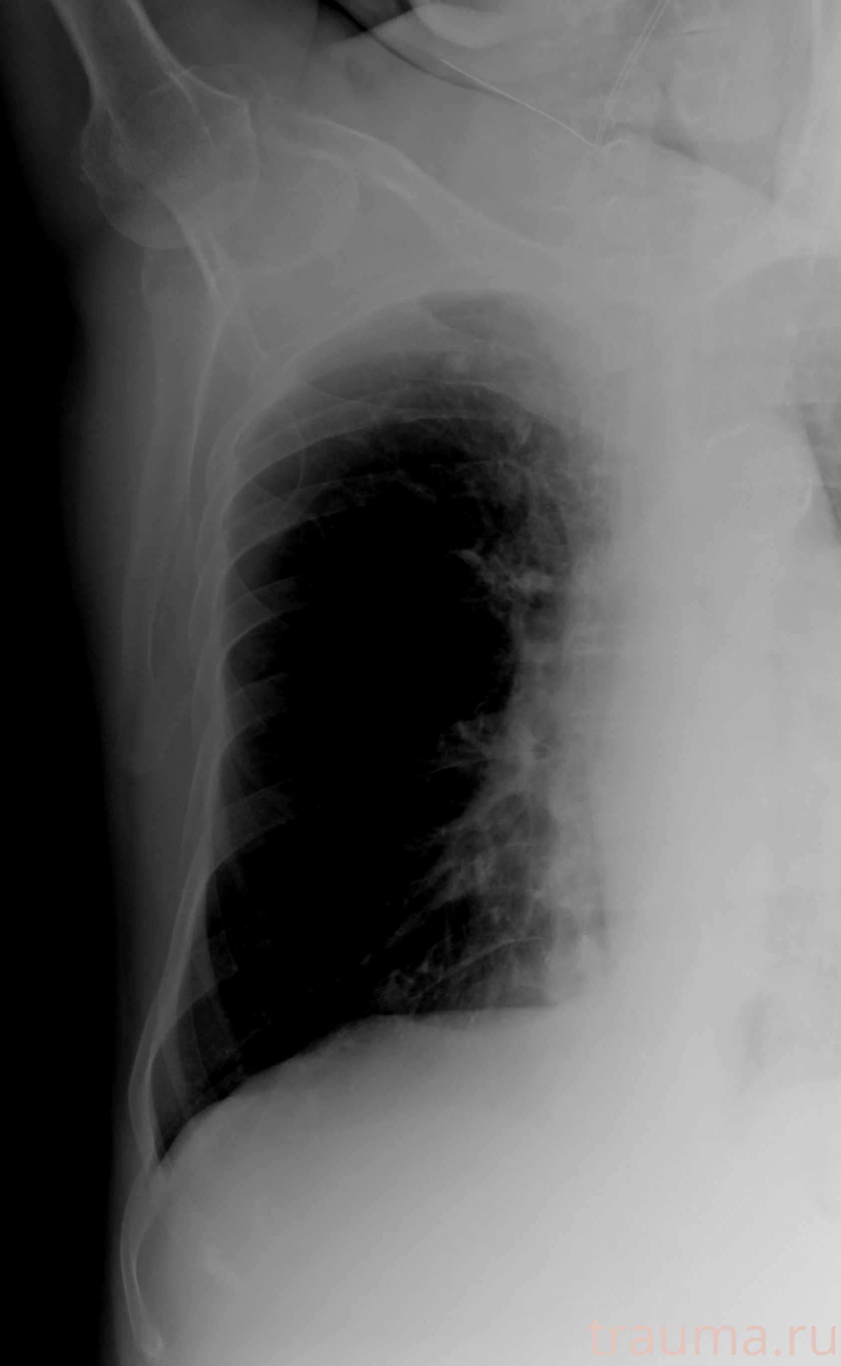 Рентген на дому: по вашему адресу приезжает врач-рентгенолог, травматолог-ортопед с мобильным рентгеновским аппаратом, проводит диагностику травмы или заболевания, делает необходимые рентгенограммы, дает рекомендации по дальнейшему лечению. Получить качественные снимки в домашних условиях возможно благодаря уникальной методике, разработанной МосРентген Центром для института  Склифосовского