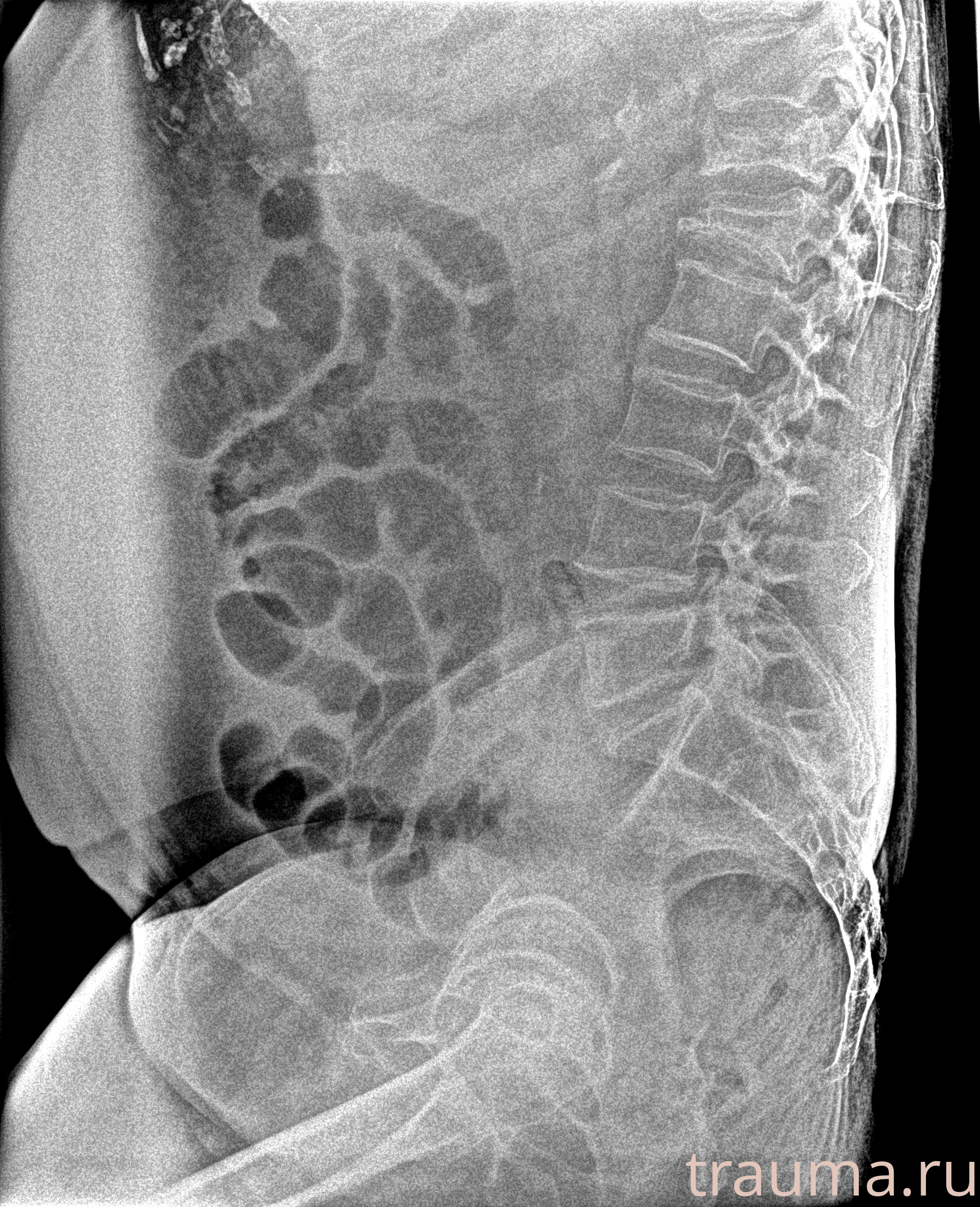 Рентген на дому: по вашему адресу приезжает врач-рентгенолог, травматолог-ортопед с мобильным рентгеновским аппаратом, проводит диагностику травмы или заболевания, делает необходимые рентгенограммы, дает рекомендации по дальнейшему лечению. Получить качественные снимки в домашних условиях возможно благодаря уникальной методике, разработанной МосРентген Центром для института  Склифосовского