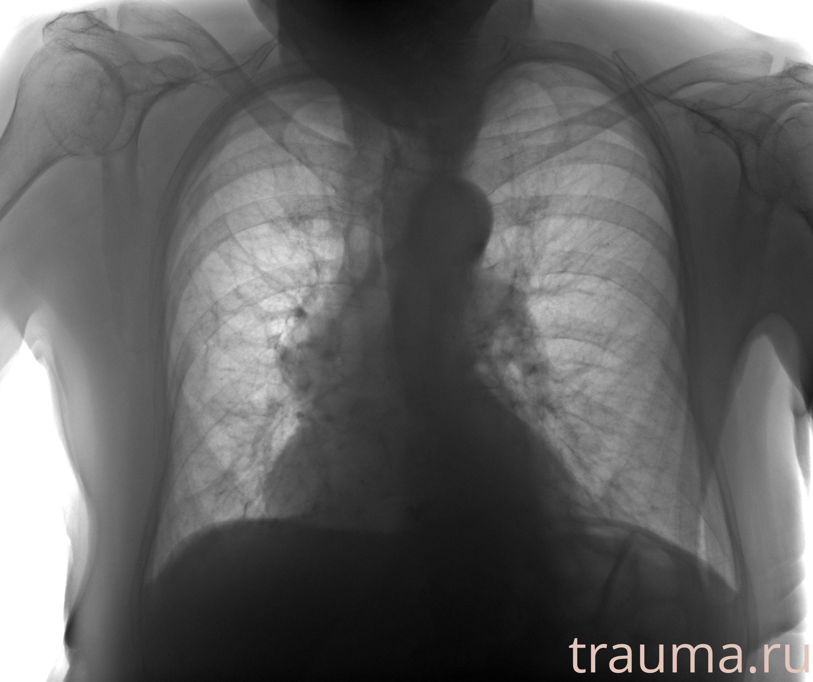 Рентген на дому: по вашему адресу приезжает врач-рентгенолог, травматолог-ортопед с мобильным рентгеновским аппаратом, проводит диагностику травмы или заболевания, делает необходимые рентгенограммы, дает рекомендации по дальнейшему лечению. Получить качественные снимки в домашних условиях возможно благодаря уникальной методике, разработанной МосРентген Центром для института  Склифосовского