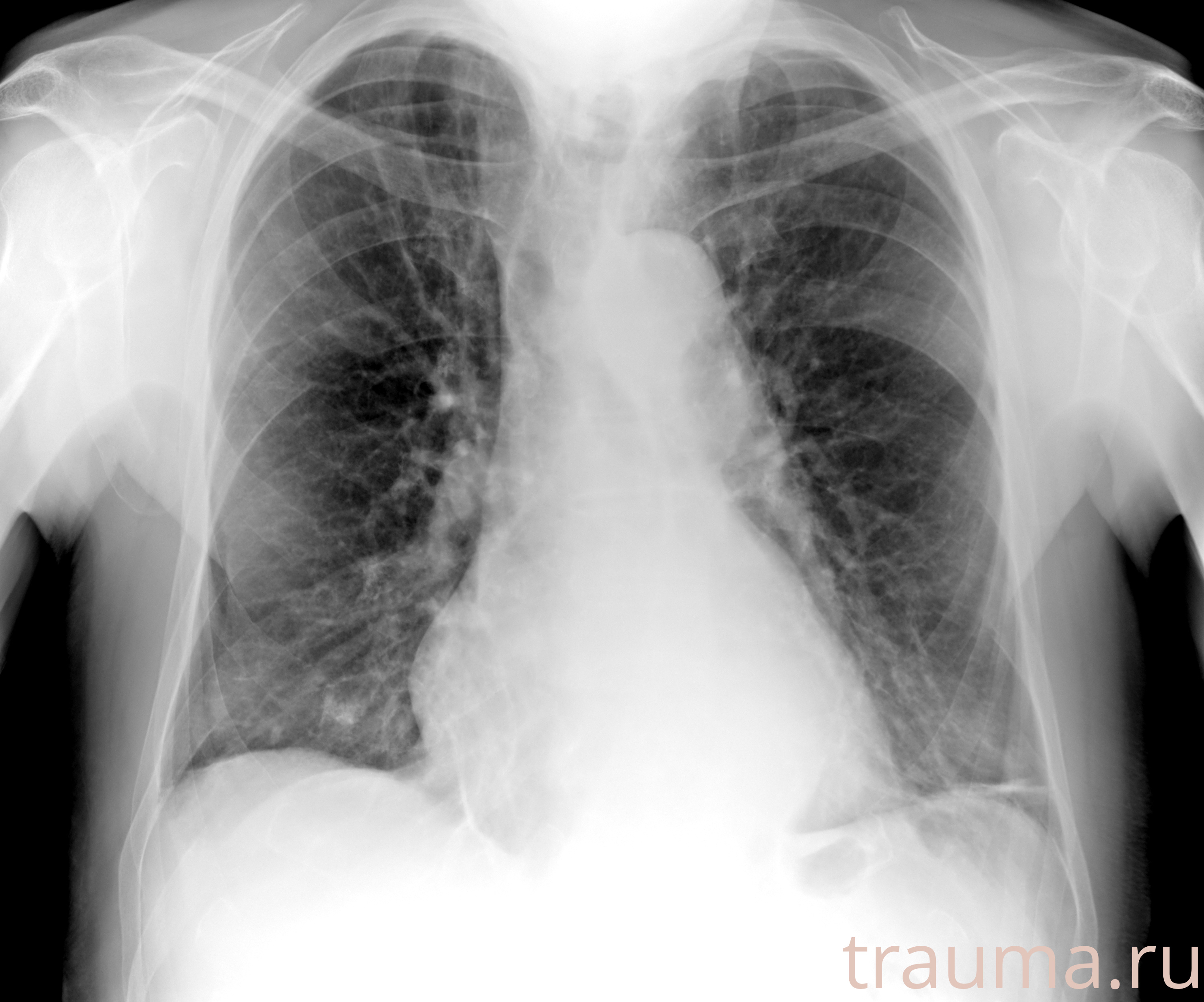 Рентген на дому: по вашему адресу приезжает врач-рентгенолог, травматолог-ортопед с мобильным рентгеновским аппаратом, проводит диагностику травмы или заболевания, делает необходимые рентгенограммы, дает рекомендации по дальнейшему лечению. Получить качественные снимки в домашних условиях возможно благодаря уникальной методике, разработанной МосРентген Центром для института  Склифосовского