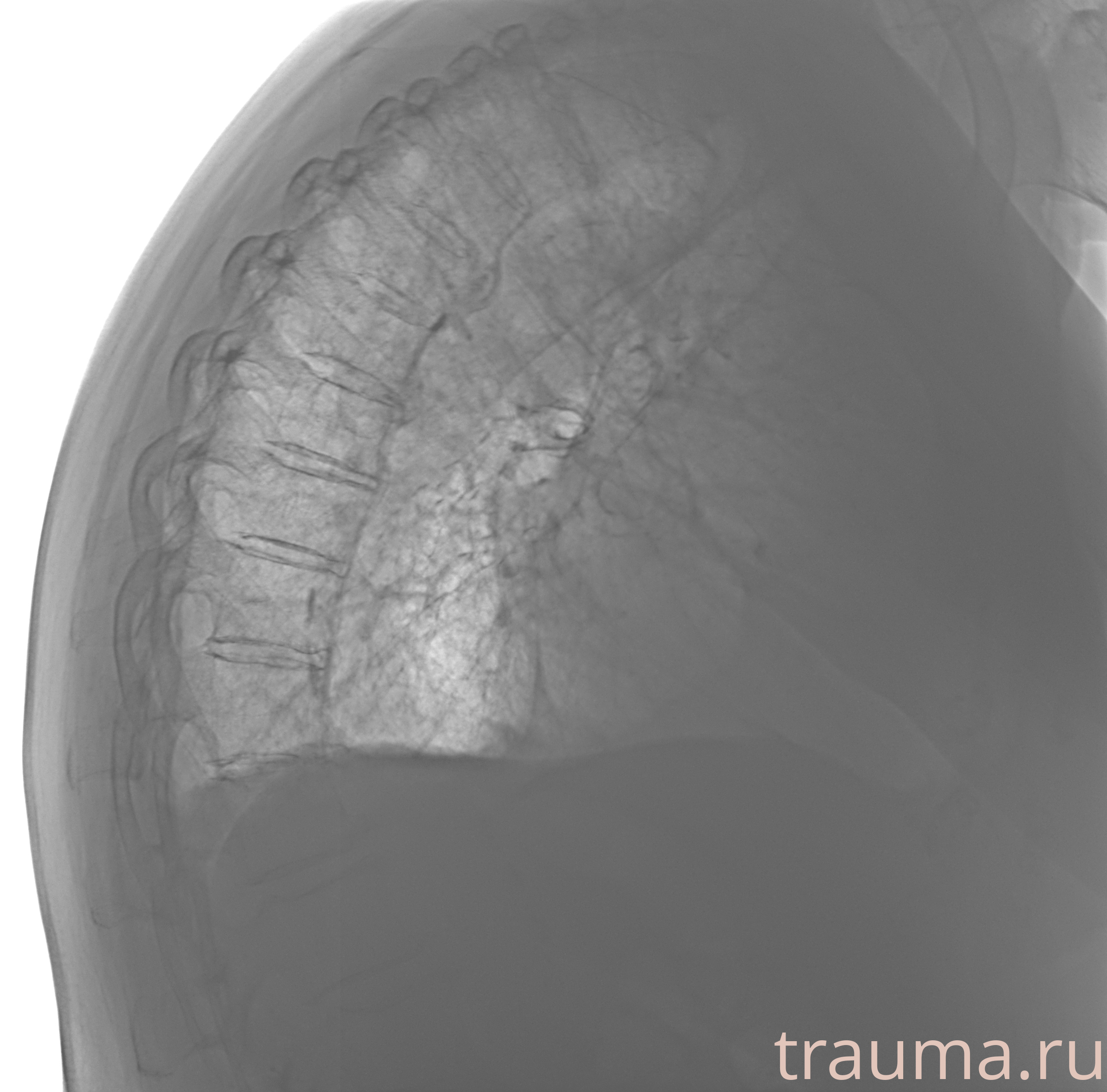 Рентген на дому: по вашему адресу приезжает врач-рентгенолог, травматолог-ортопед с мобильным рентгеновским аппаратом, проводит диагностику травмы или заболевания, делает необходимые рентгенограммы, дает рекомендации по дальнейшему лечению. Получить качественные снимки в домашних условиях возможно благодаря уникальной методике, разработанной МосРентген Центром для института  Склифосовского