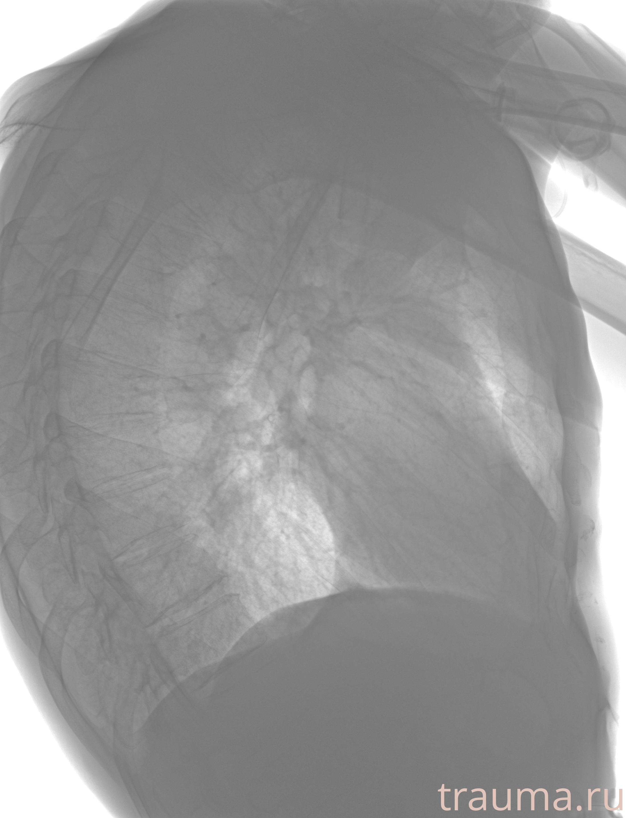 Рентген на дому: по вашему адресу приезжает врач-рентгенолог, травматолог-ортопед с мобильным рентгеновским аппаратом, проводит диагностику травмы или заболевания, делает необходимые рентгенограммы, дает рекомендации по дальнейшему лечению. Получить качественные снимки в домашних условиях возможно благодаря уникальной методике, разработанной МосРентген Центром для института  Склифосовского