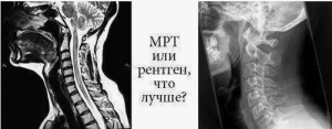 Автоматическое распознавание патологий на рентгеновских, КТ и МРТ снимках