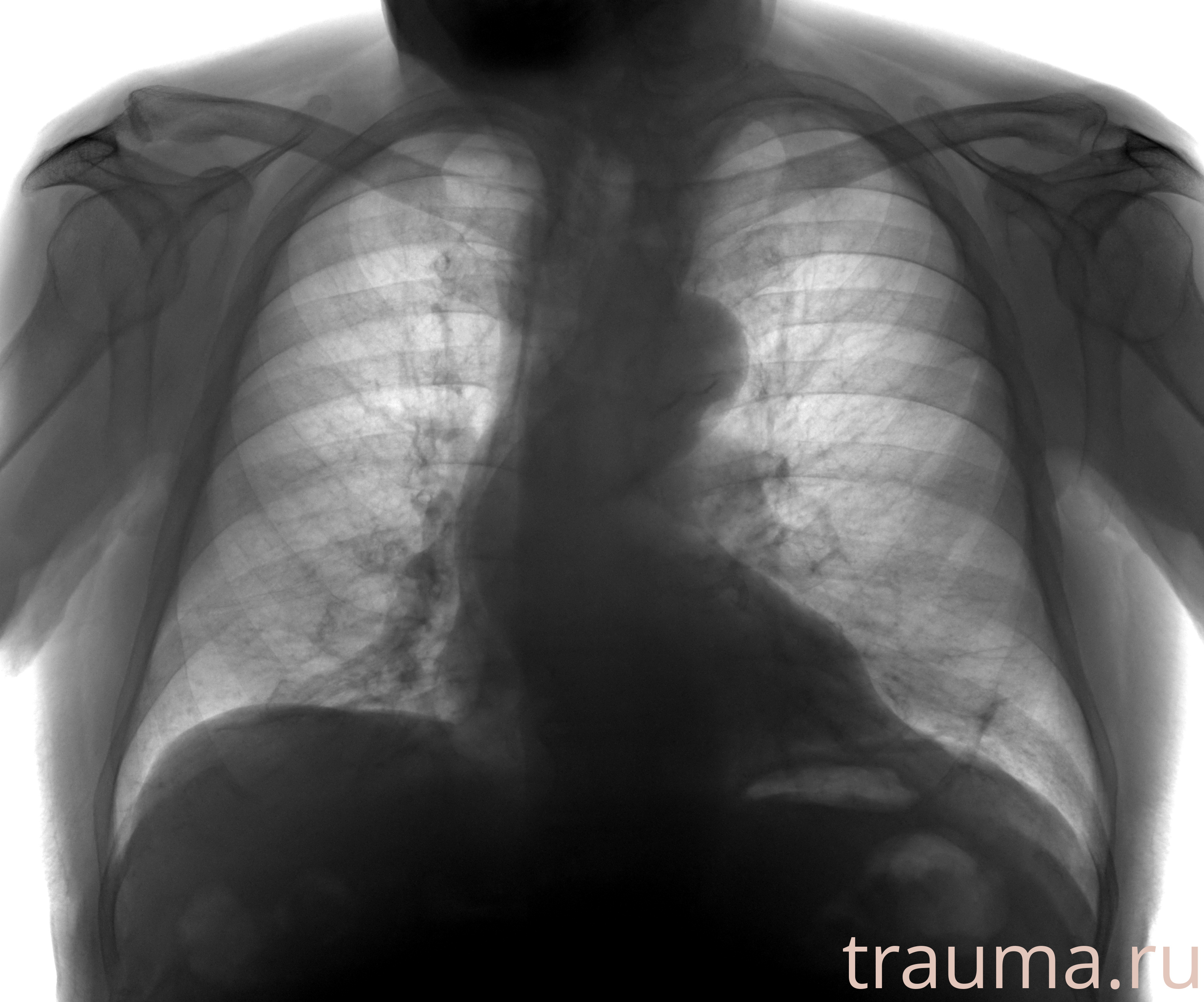 Рентген на дому: по вашему адресу приезжает врач-рентгенолог, травматолог-ортопед с мобильным рентгеновским аппаратом, проводит диагностику травмы или заболевания, делает необходимые рентгенограммы, дает рекомендации по дальнейшему лечению. Получить качественные снимки в домашних условиях возможно благодаря уникальной методике, разработанной МосРентген Центром для института  Склифосовского