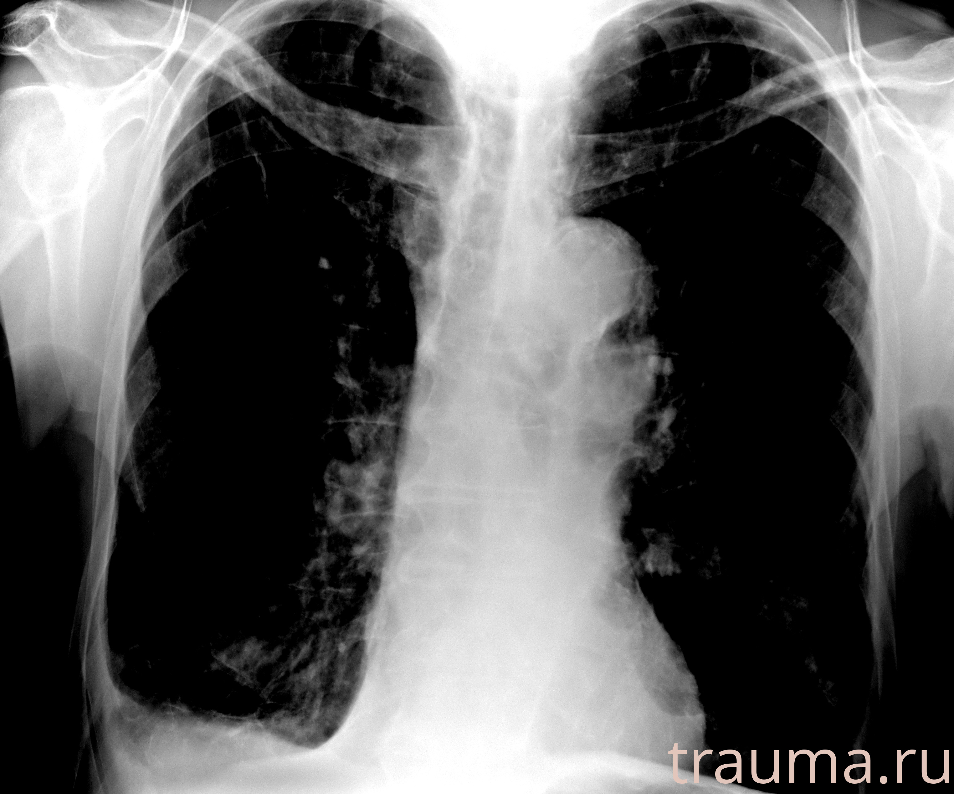 Рентген на дому: по вашему адресу приезжает врач-рентгенолог, травматолог-ортопед с мобильным рентгеновским аппаратом, проводит диагностику травмы или заболевания, делает необходимые рентгенограммы, дает рекомендации по дальнейшему лечению. Получить качественные снимки в домашних условиях возможно благодаря уникальной методике, разработанной МосРентген Центром для института  Склифосовского