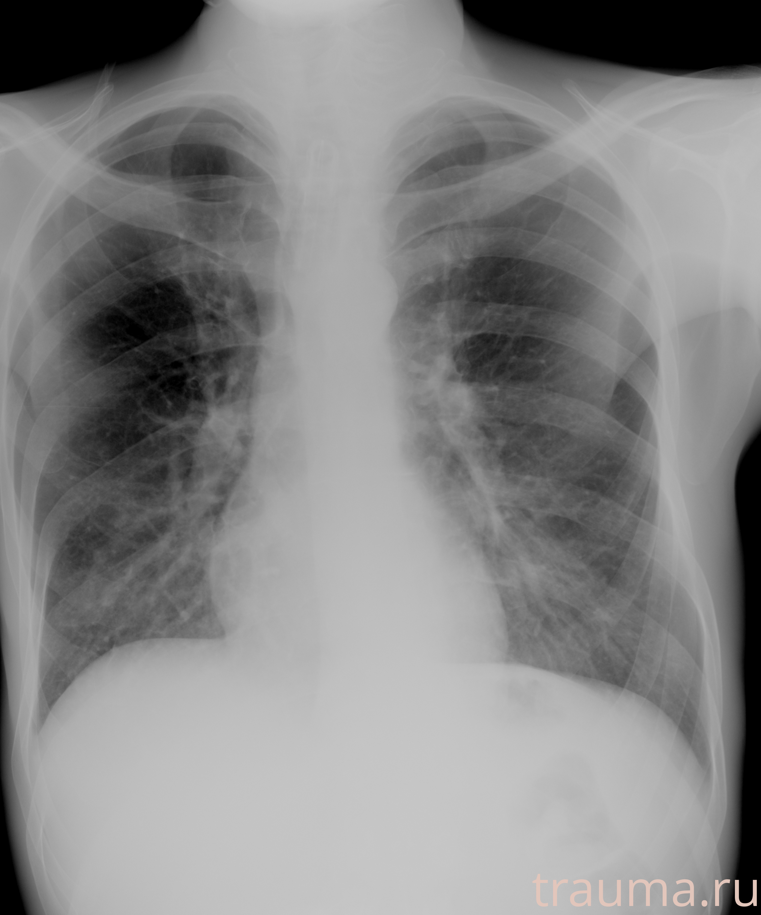 Рентген на дому: по вашему адресу приезжает врач-рентгенолог, травматолог-ортопед с мобильным рентгеновским аппаратом, проводит диагностику травмы или заболевания, делает необходимые рентгенограммы, дает рекомендации по дальнейшему лечению. Получить качественные снимки в домашних условиях возможно благодаря уникальной методике, разработанной МосРентген Центром для института  Склифосовского