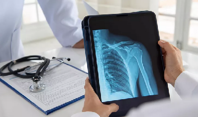 Ученые улучшили "зрение" рентгеновских аппаратов Ученые улучшили "зрение" рентгеновских аппаратов