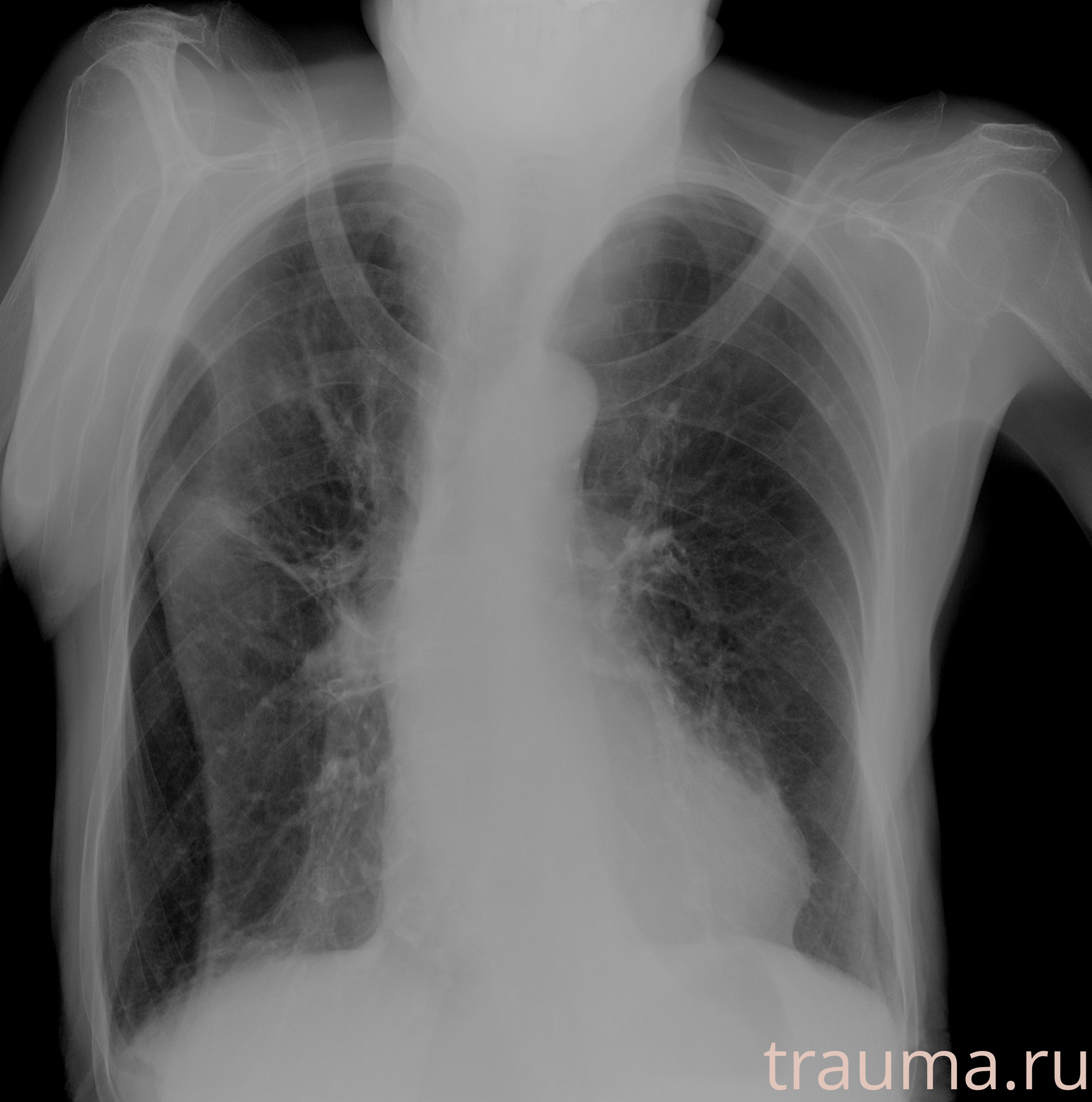 Рентген на дому: по вашему адресу приезжает врач-рентгенолог, травматолог-ортопед с мобильным рентгеновским аппаратом, проводит диагностику травмы или заболевания, делает необходимые рентгенограммы, дает рекомендации по дальнейшему лечению. Получить качественные снимки в домашних условиях возможно благодаря уникальной методике, разработанной МосРентген Центром для института  Склифосовского