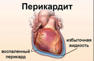 Курс медицинской рентгенологии.Рентгенологическое исследование органов кровообращения(сердца и больших сосудов).Часть 2. Глава 8.7 Курс медицинской рентгенологии.Рентгенологическое исследование органов кровообращения(сердца и больших сосудов).Часть 2. Глава 8.7