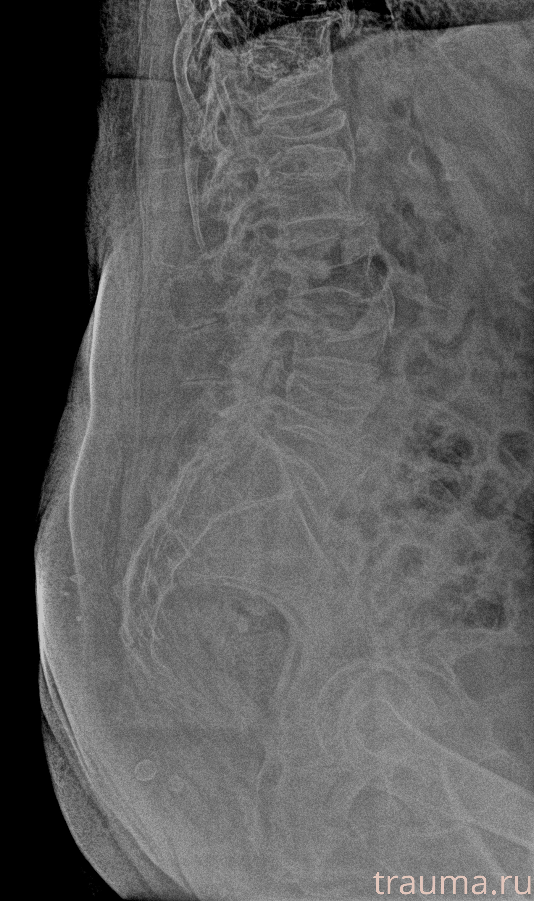 Рентген на дому: по вашему адресу приезжает врач-рентгенолог, травматолог-ортопед с мобильным рентгеновским аппаратом, проводит диагностику травмы или заболевания, делает необходимые рентгенограммы, дает рекомендации по дальнейшему лечению. Получить качественные снимки в домашних условиях возможно благодаря уникальной методике, разработанной МосРентген Центром для института  Склифосовского