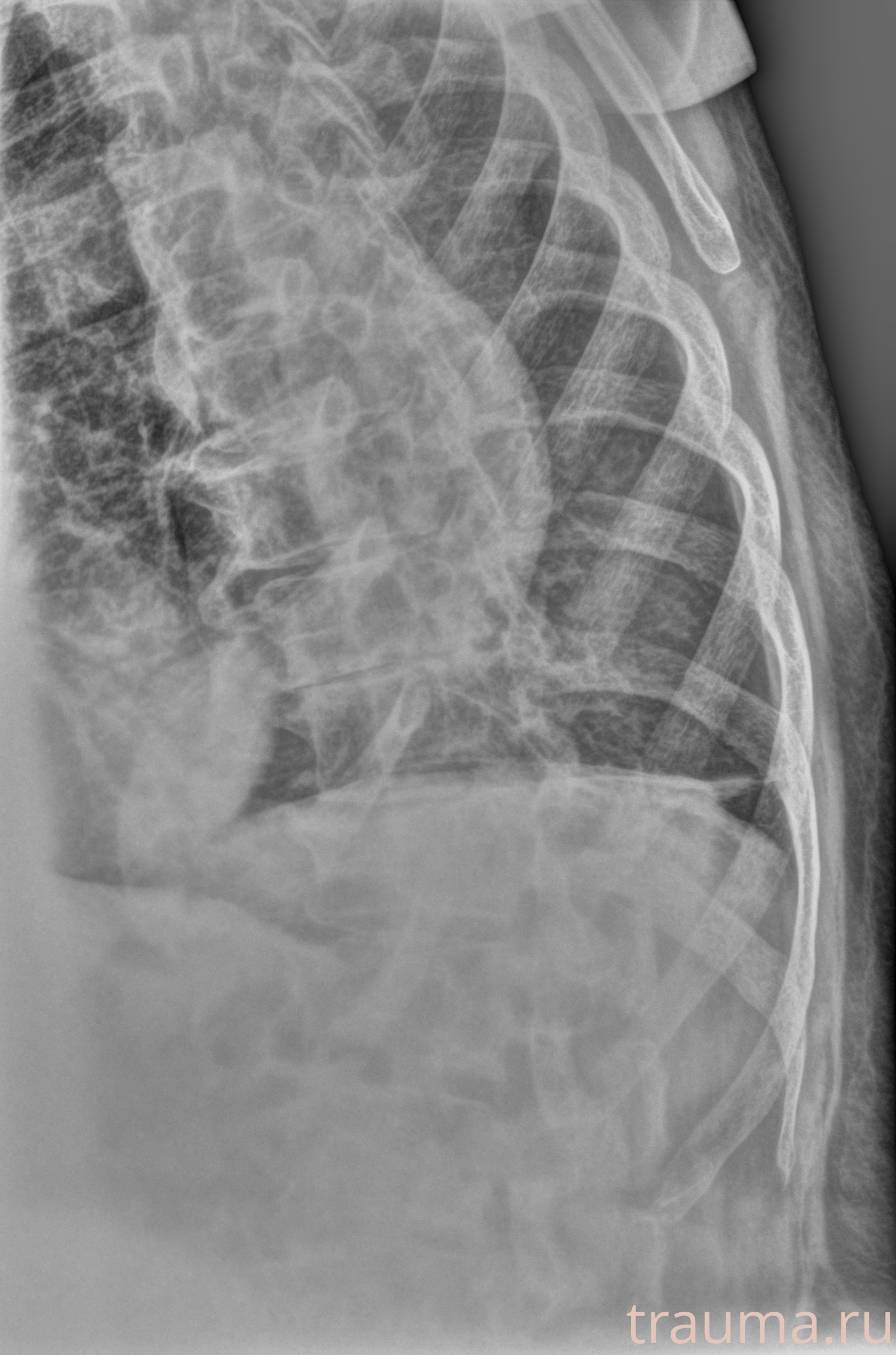 Рентген на дому: по вашему адресу приезжает врач-рентгенолог, травматолог-ортопед с мобильным рентгеновским аппаратом, проводит диагностику травмы или заболевания, делает необходимые рентгенограммы, дает рекомендации по дальнейшему лечению. Получить качественные снимки в домашних условиях возможно благодаря уникальной методике, разработанной МосРентген Центром для института  Склифосовского