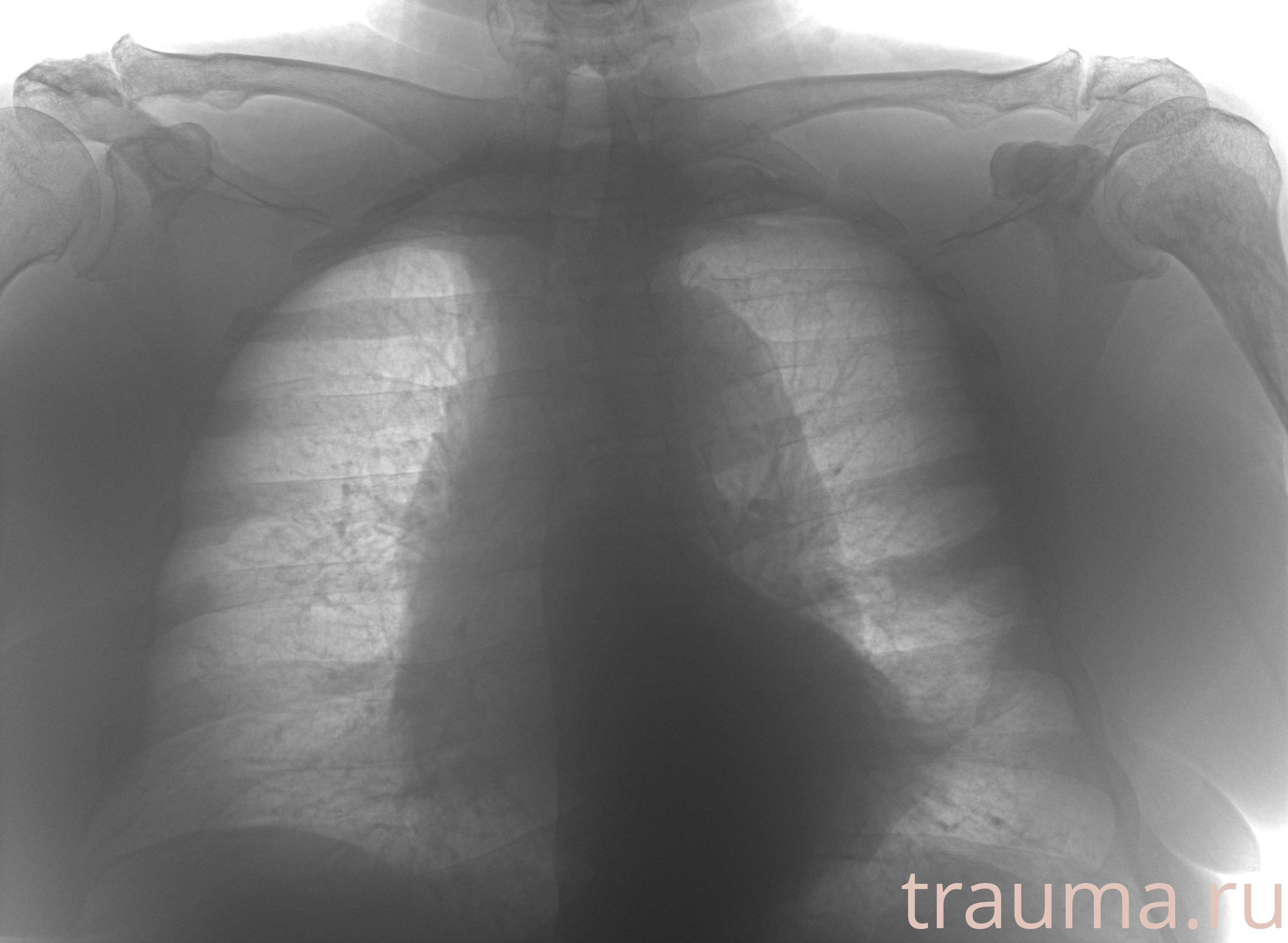 Рентген на дому: по вашему адресу приезжает врач-рентгенолог, травматолог-ортопед с мобильным рентгеновским аппаратом, проводит диагностику травмы или заболевания, делает необходимые рентгенограммы, дает рекомендации по дальнейшему лечению. Получить качественные снимки в домашних условиях возможно благодаря уникальной методике, разработанной МосРентген Центром для института  Склифосовского