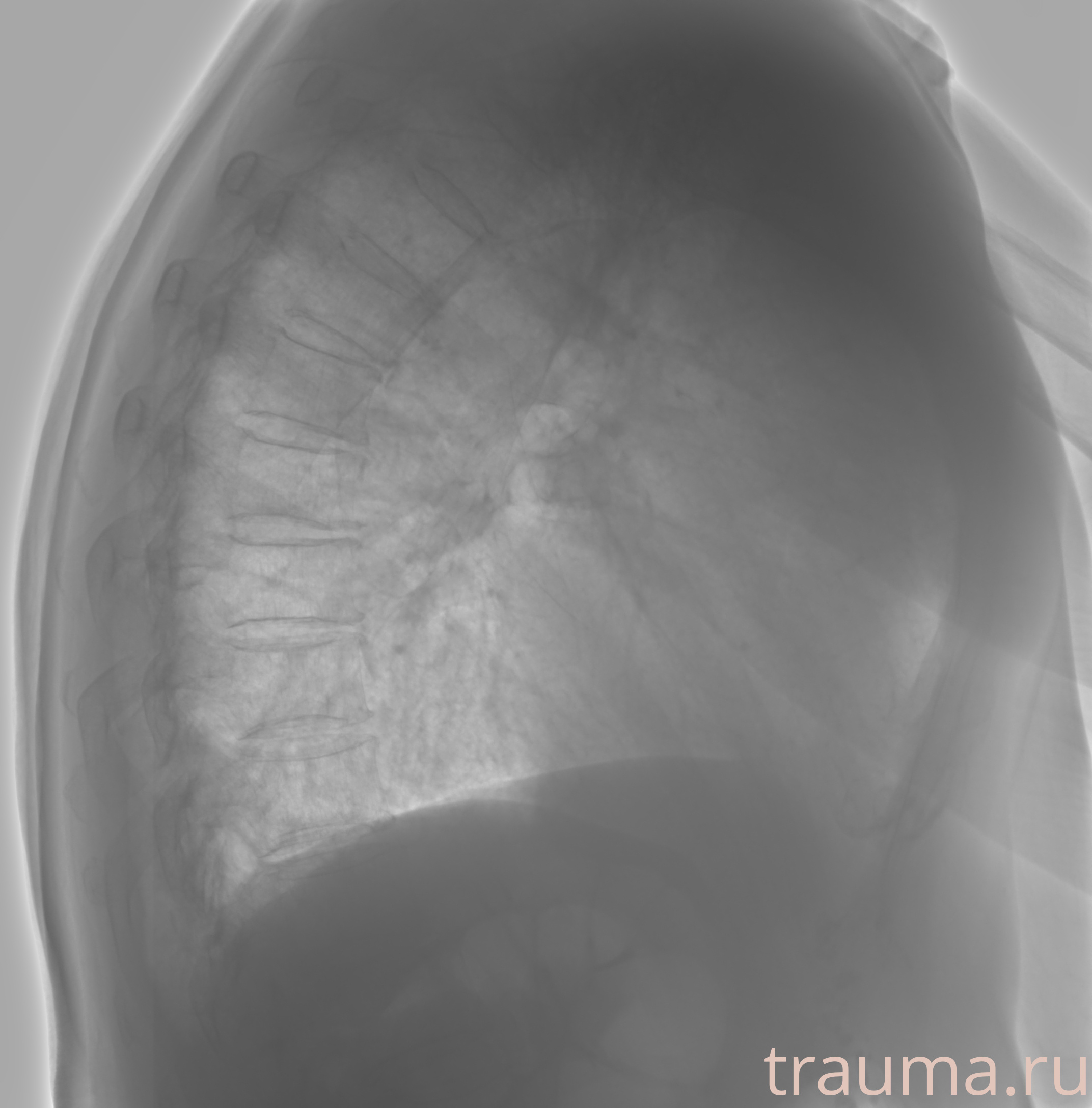 Рентген на дому: по вашему адресу приезжает врач-рентгенолог, травматолог-ортопед с мобильным рентгеновским аппаратом, проводит диагностику травмы или заболевания, делает необходимые рентгенограммы, дает рекомендации по дальнейшему лечению. Получить качественные снимки в домашних условиях возможно благодаря уникальной методике, разработанной МосРентген Центром для института  Склифосовского