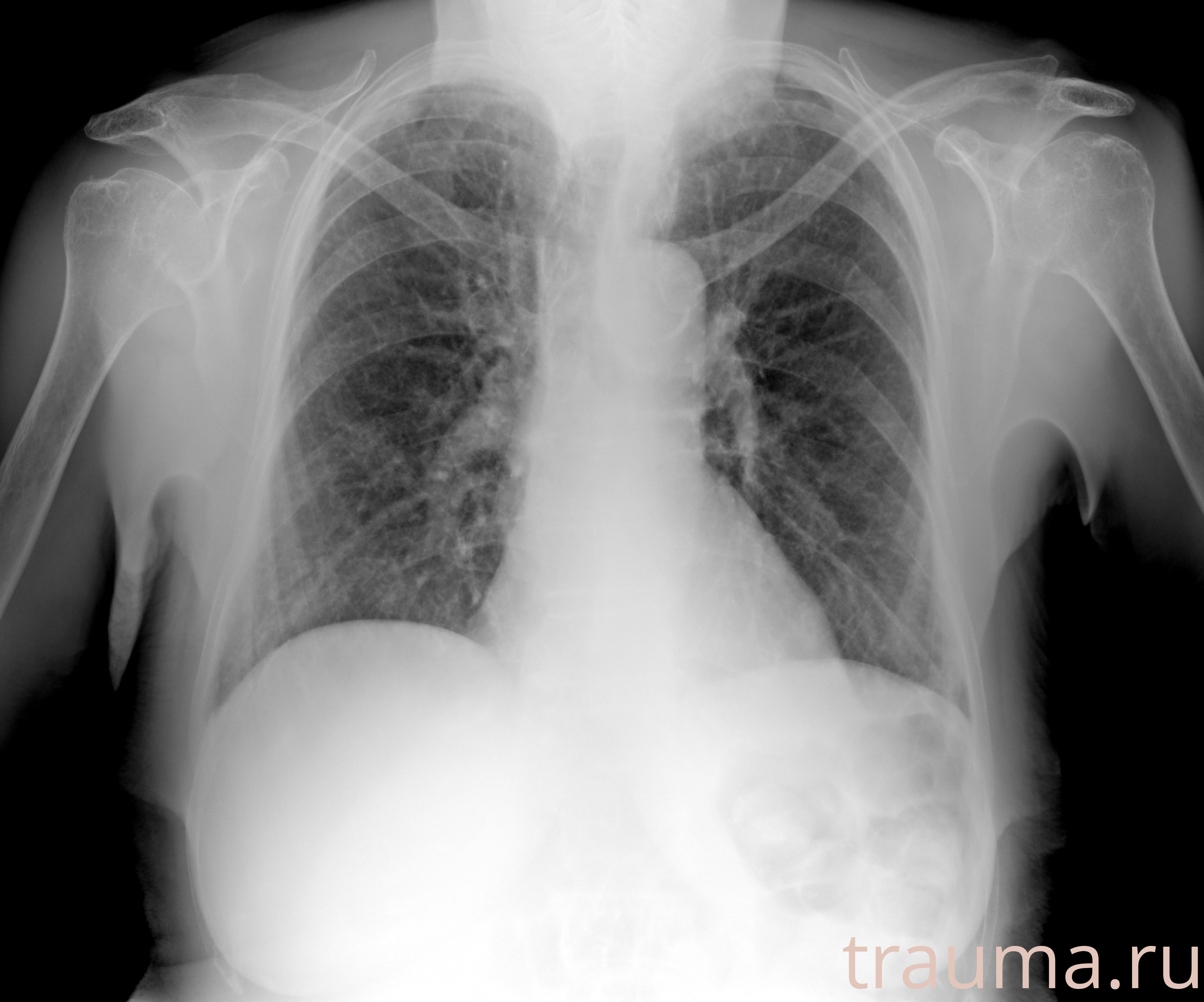 Рентген на дому: по вашему адресу приезжает врач-рентгенолог, травматолог-ортопед с мобильным рентгеновским аппаратом, проводит диагностику травмы или заболевания, делает необходимые рентгенограммы, дает рекомендации по дальнейшему лечению. Получить качественные снимки в домашних условиях возможно благодаря уникальной методике, разработанной МосРентген Центром для института  Склифосовского