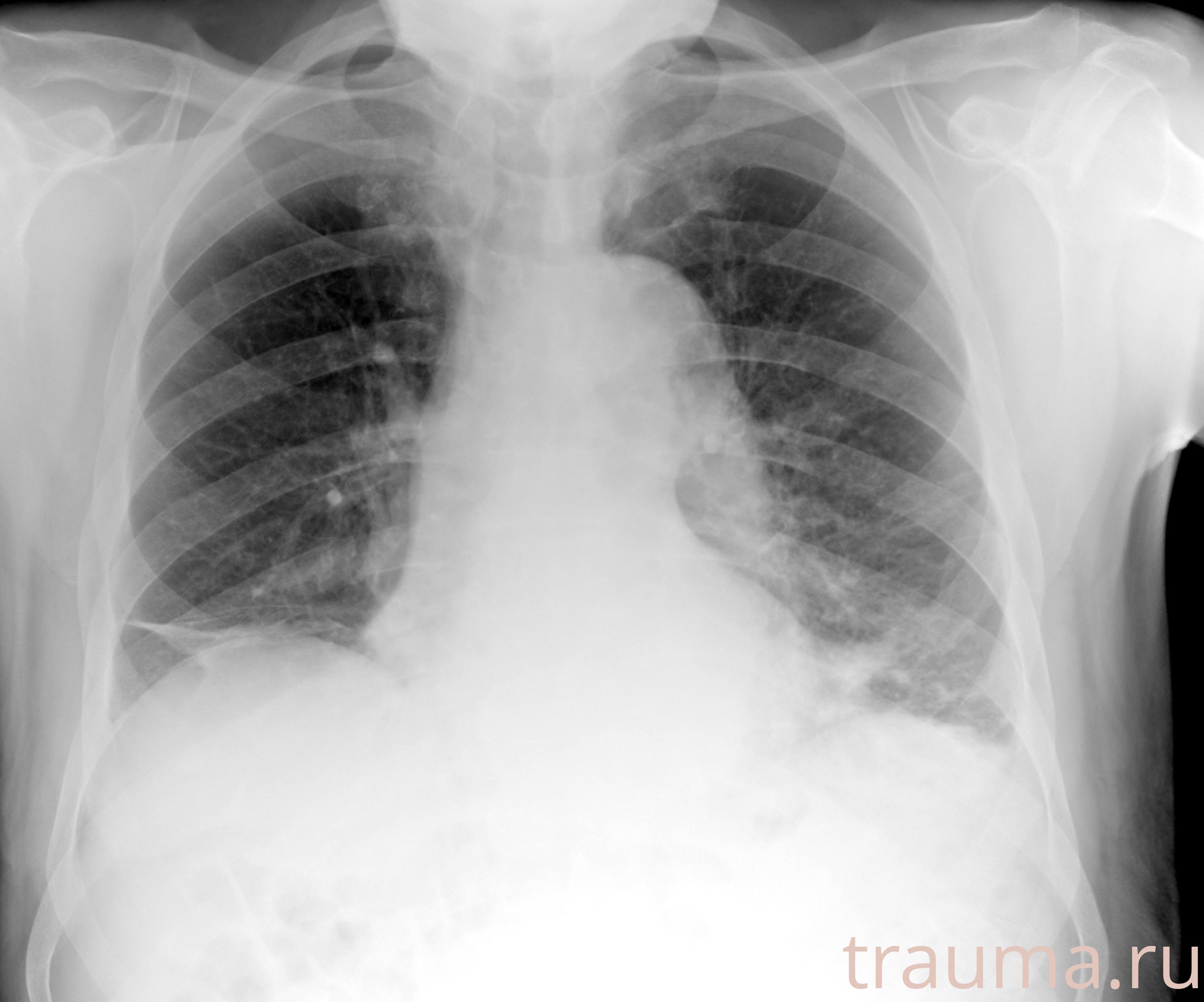 Рентген на дому: по вашему адресу приезжает врач-рентгенолог, травматолог-ортопед с мобильным рентгеновским аппаратом, проводит диагностику травмы или заболевания, делает необходимые рентгенограммы, дает рекомендации по дальнейшему лечению. Получить качественные снимки в домашних условиях возможно благодаря уникальной методике, разработанной МосРентген Центром для института  Склифосовского