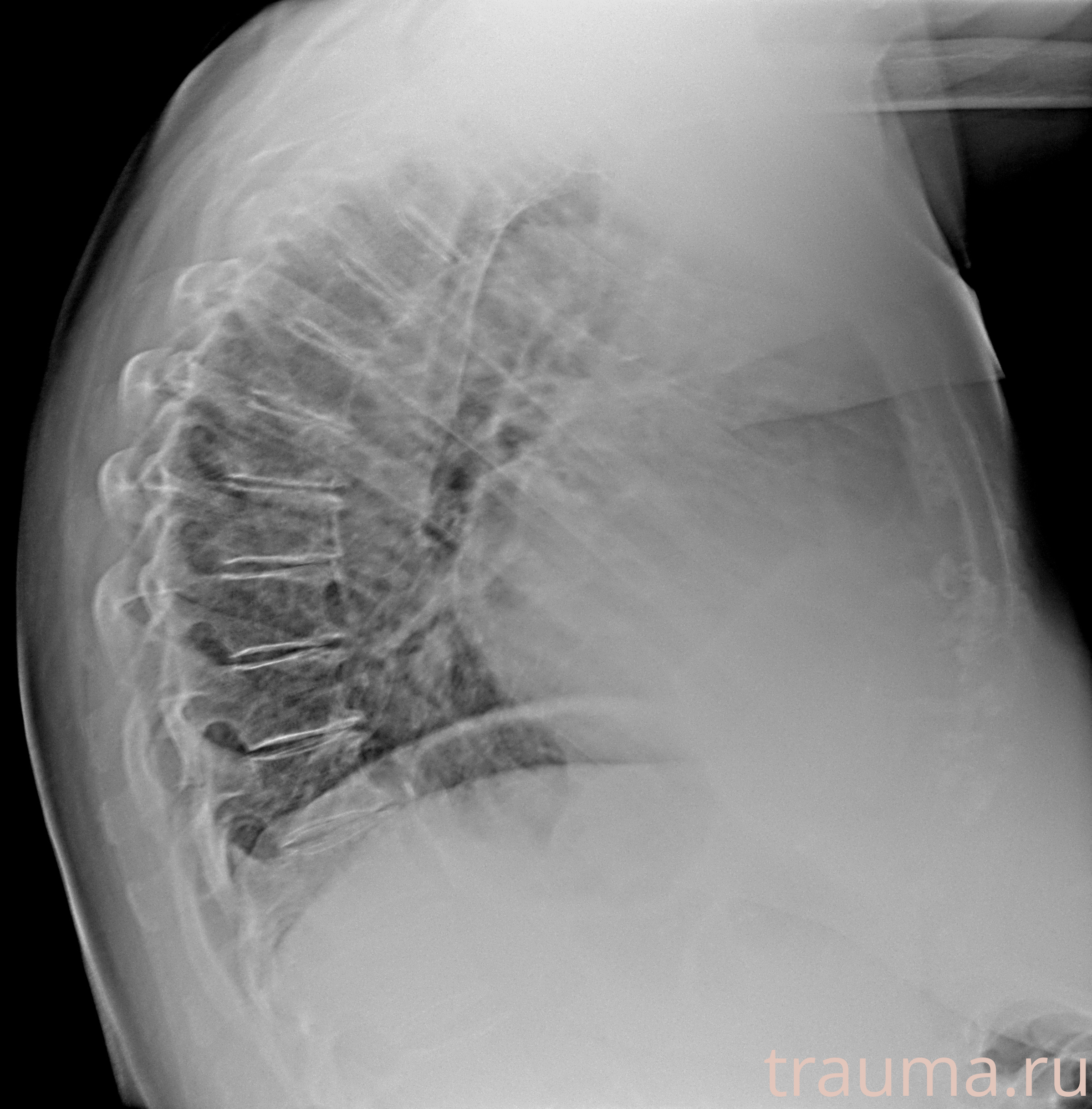 Рентген на дому: по вашему адресу приезжает врач-рентгенолог, травматолог-ортопед с мобильным рентгеновским аппаратом, проводит диагностику травмы или заболевания, делает необходимые рентгенограммы, дает рекомендации по дальнейшему лечению. Получить качественные снимки в домашних условиях возможно благодаря уникальной методике, разработанной МосРентген Центром для института  Склифосовского