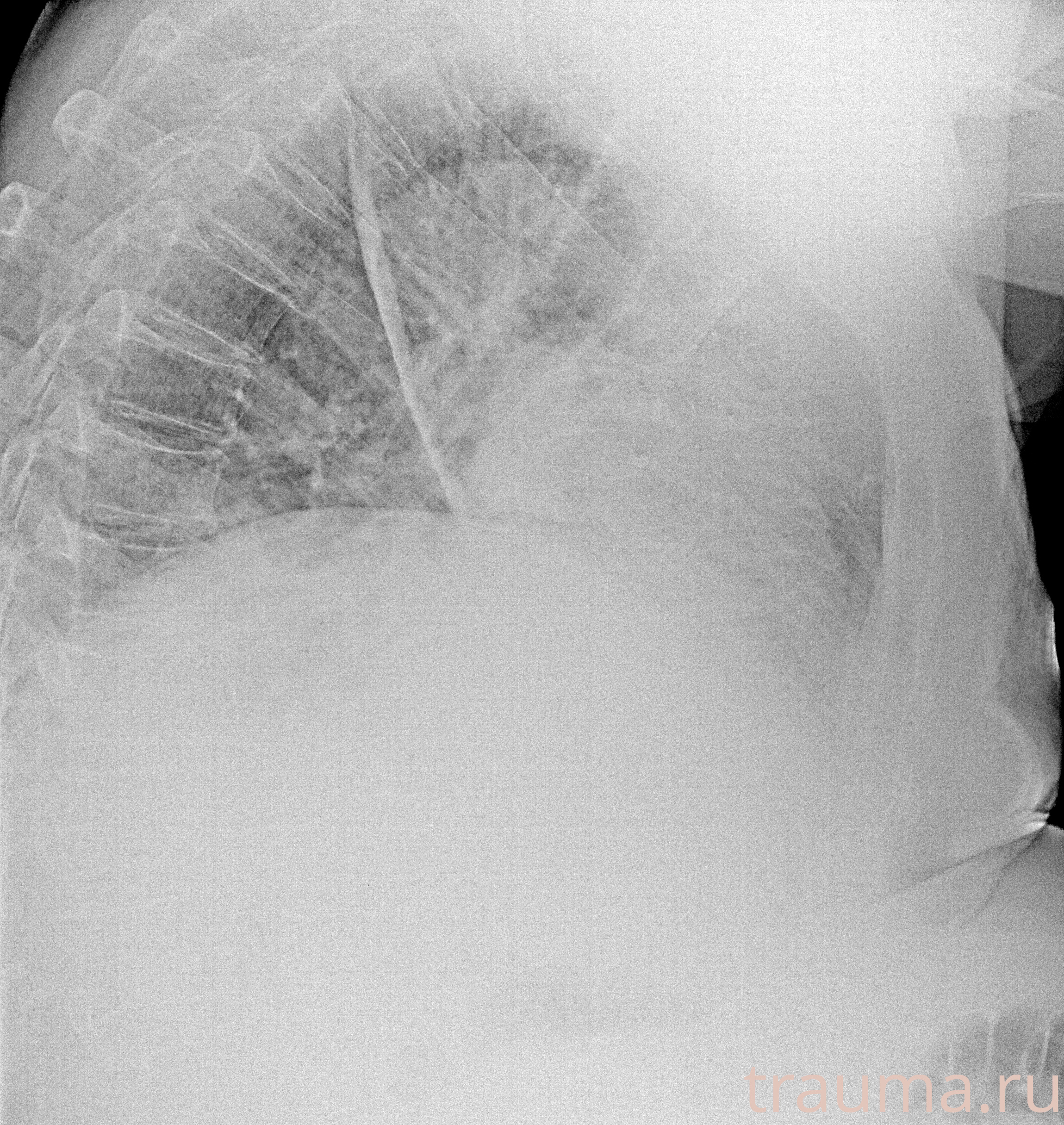 Рентген на дому: по вашему адресу приезжает врач-рентгенолог, травматолог-ортопед с мобильным рентгеновским аппаратом, проводит диагностику травмы или заболевания, делает необходимые рентгенограммы, дает рекомендации по дальнейшему лечению. Получить качественные снимки в домашних условиях возможно благодаря уникальной методике, разработанной МосРентген Центром для института  Склифосовского