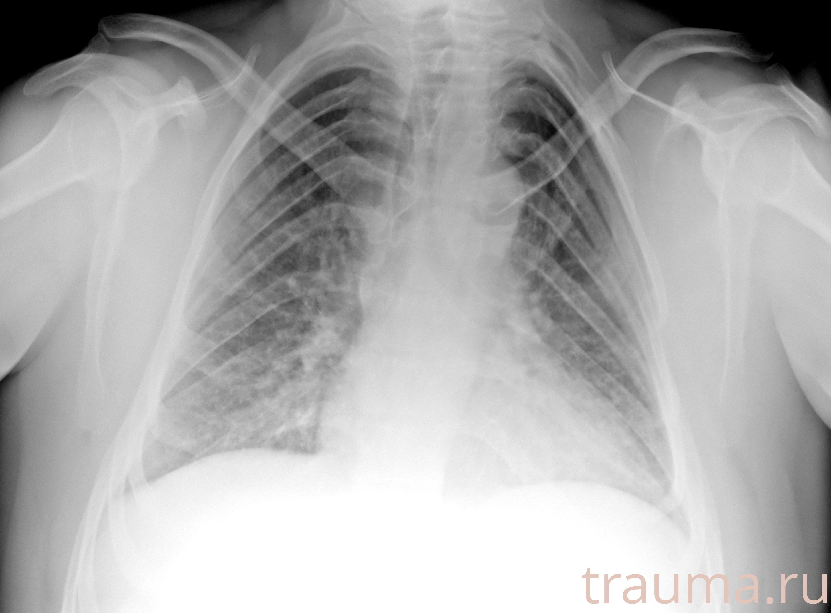 Рентген на дому: по вашему адресу приезжает врач-рентгенолог, травматолог-ортопед с мобильным рентгеновским аппаратом, проводит диагностику травмы или заболевания, делает необходимые рентгенограммы, дает рекомендации по дальнейшему лечению. Получить качественные снимки в домашних условиях возможно благодаря уникальной методике, разработанной МосРентген Центром для института  Склифосовского