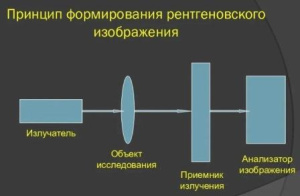 Курс медицинской рентгенологии. Рентгенодиагностика. Часть 2. Глава 3 Курс медицинской рентгенологии. Рентгенодиагностика. Часть 2. Глава 3