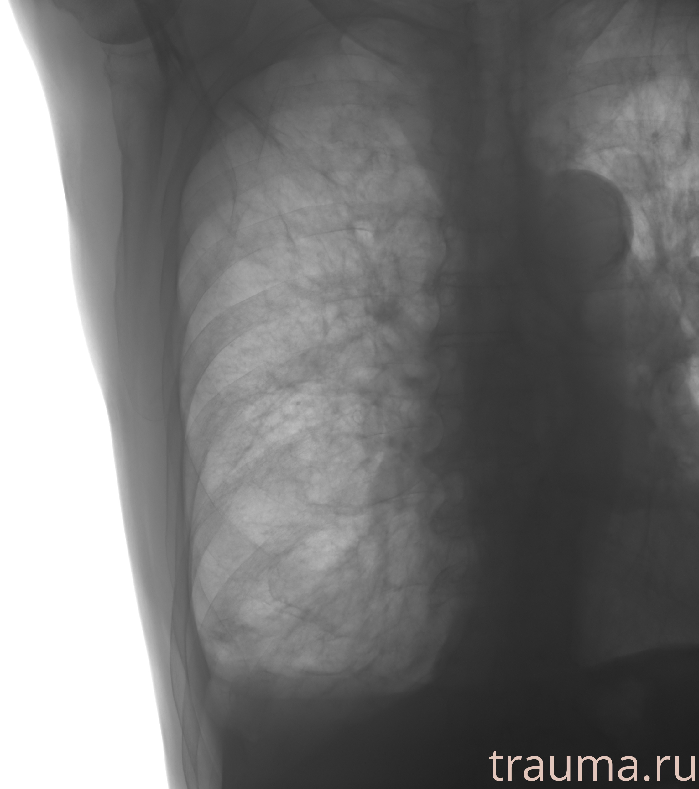 Рентген на дому: по вашему адресу приезжает врач-рентгенолог, травматолог-ортопед с мобильным рентгеновским аппаратом, проводит диагностику травмы или заболевания, делает необходимые рентгенограммы, дает рекомендации по дальнейшему лечению. Получить качественные снимки в домашних условиях возможно благодаря уникальной методике, разработанной МосРентген Центром для института  Склифосовского