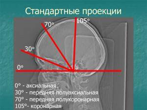 Атлас укладок при рентгенологических исследованиях (Кишковский А.Н.) - Глава 3.Часть 2 Атлас укладок при рентгенологических исследованиях (Кишковский А.Н.) - Глава 3.Часть 2