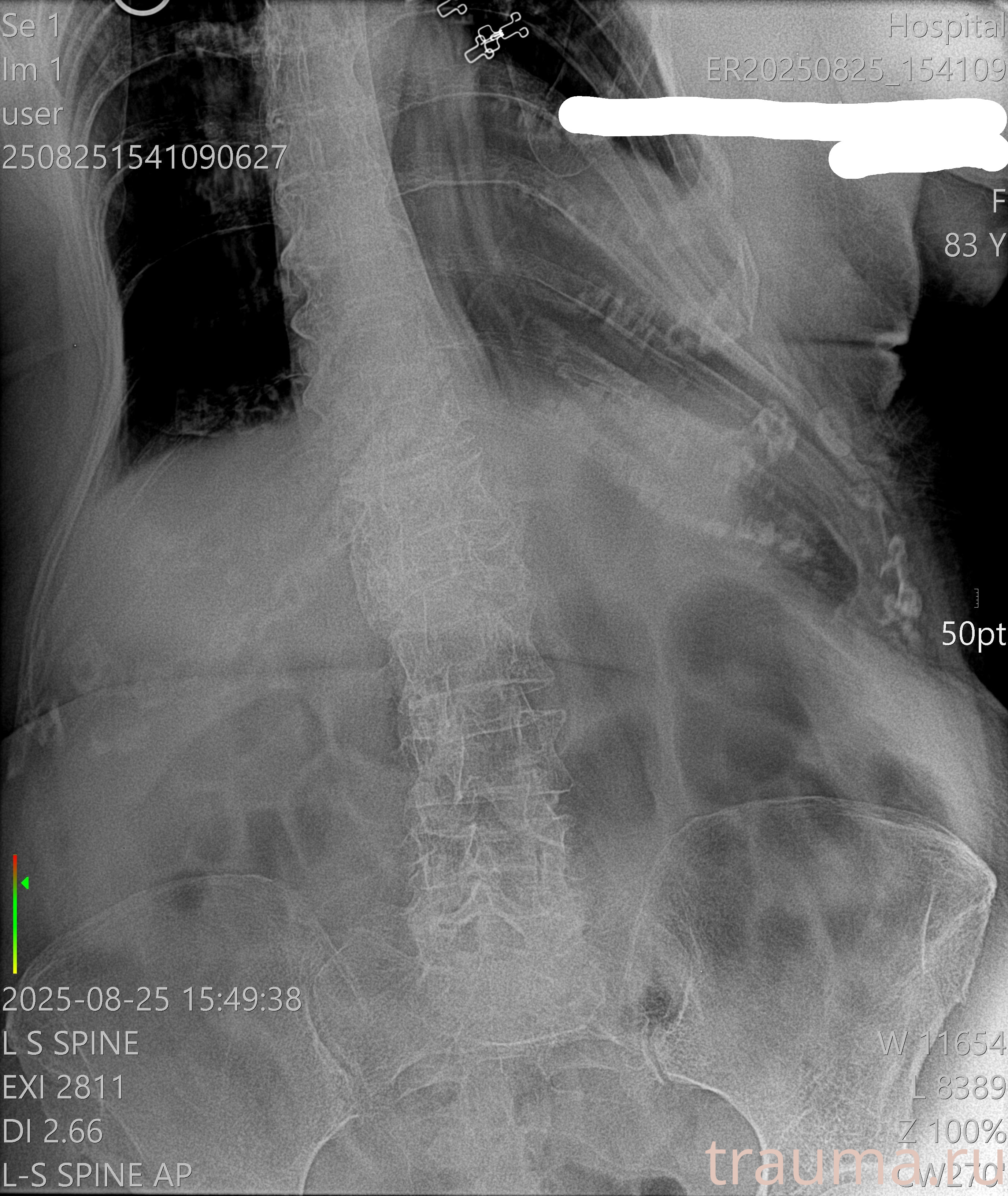 Рентген на дому: по вашему адресу приезжает врач-рентгенолог, травматолог-ортопед с мобильным рентгеновским аппаратом, проводит диагностику травмы или заболевания, делает необходимые рентгенограммы, дает рекомендации по дальнейшему лечению. Получить качественные снимки в домашних условиях возможно благодаря уникальной методике, разработанной МосРентген Центром для института  Склифосовского