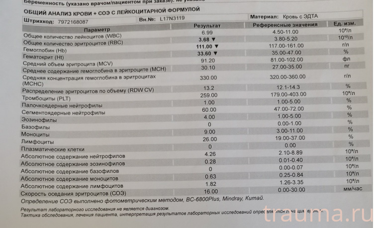 Рентген на дому: по вашему адресу приезжает врач-рентгенолог, травматолог-ортопед с мобильным рентгеновским аппаратом, проводит диагностику травмы или заболевания, делает необходимые рентгенограммы, дает рекомендации по дальнейшему лечению. Получить качественные снимки в домашних условиях возможно благодаря уникальной методике, разработанной МосРентген Центром для института  Склифосовского