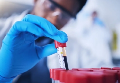 Эксперт Бусыгин рассказал, можно ли после рентгена сдавать анализы