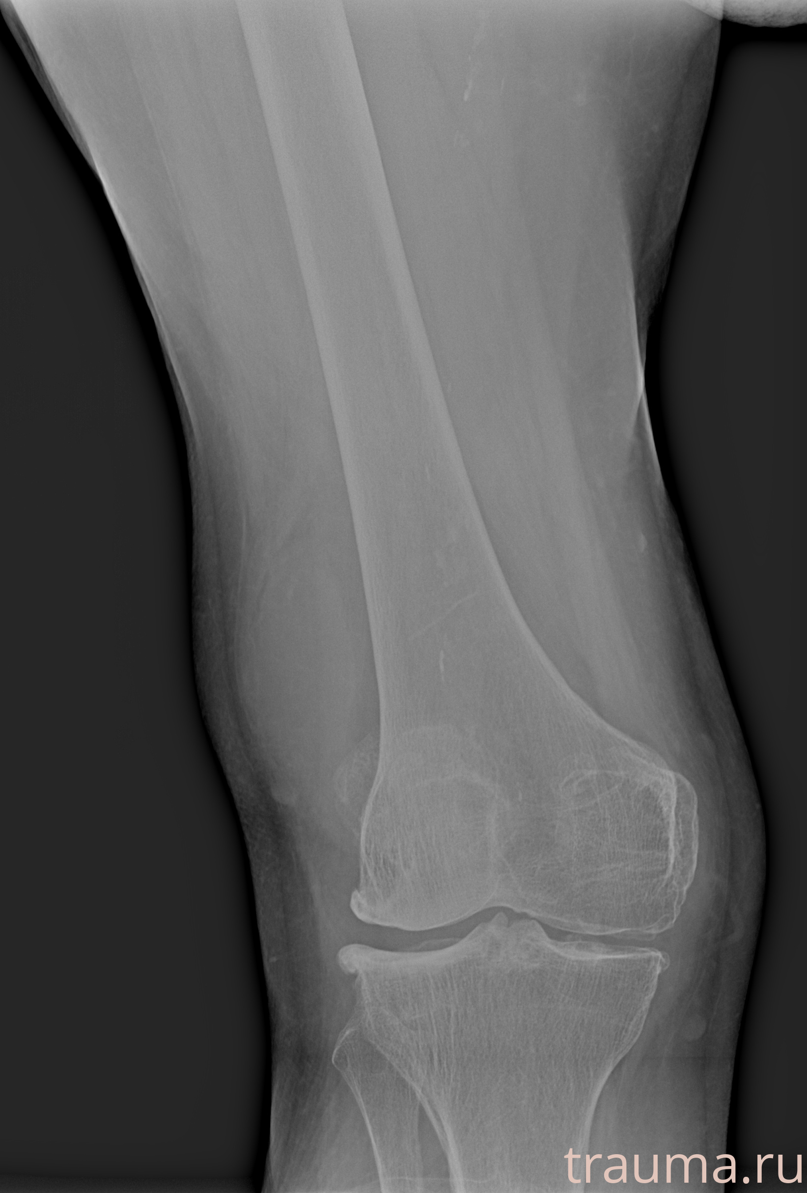 Рентген на дому: по вашему адресу приезжает врач-рентгенолог, травматолог-ортопед с мобильным рентгеновским аппаратом, проводит диагностику травмы или заболевания, делает необходимые рентгенограммы, дает рекомендации по дальнейшему лечению. Получить качественные снимки в домашних условиях возможно благодаря уникальной методике, разработанной МосРентген Центром для института  Склифосовского