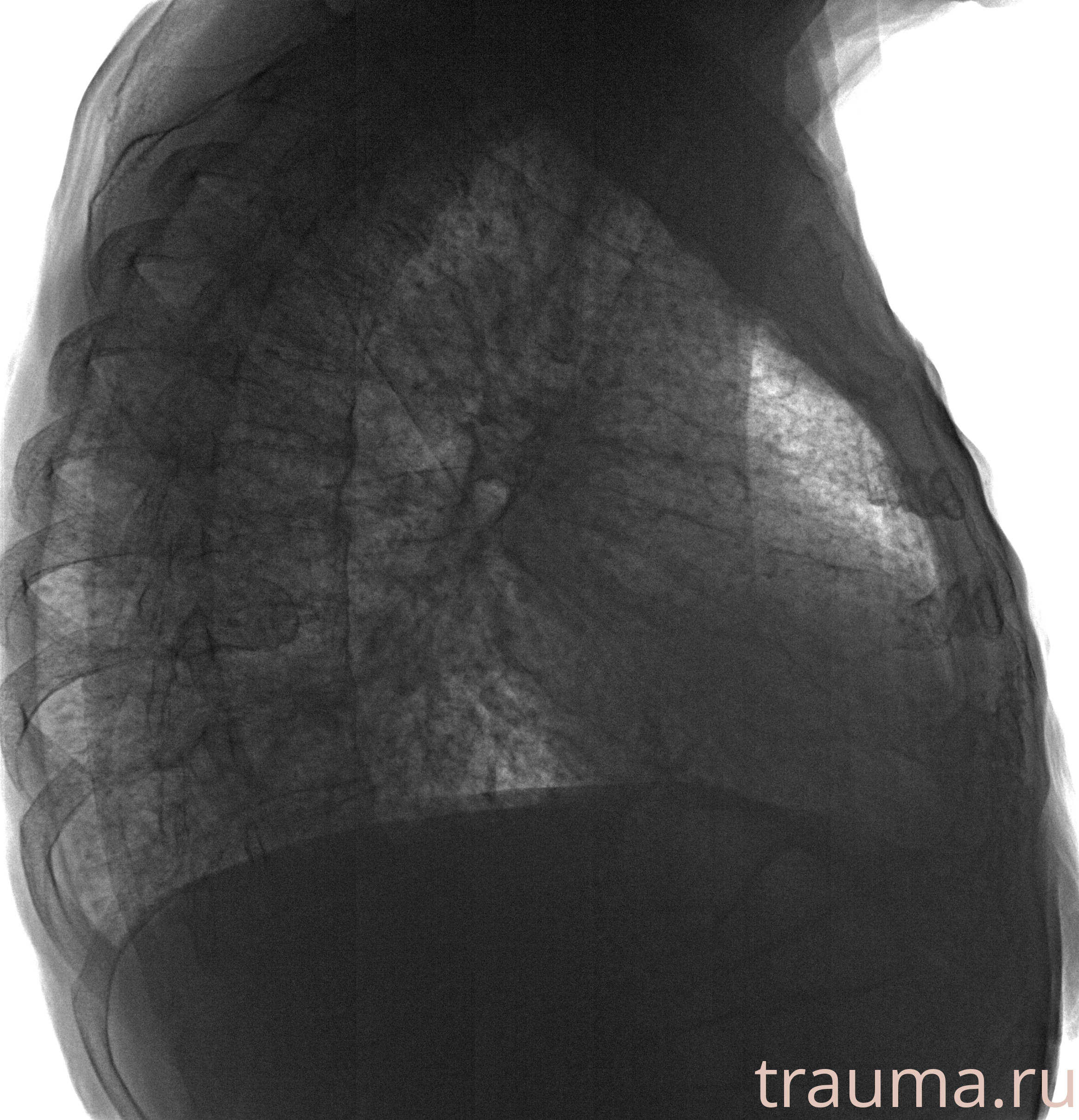 Рентген на дому: по вашему адресу приезжает врач-рентгенолог, травматолог-ортопед с мобильным рентгеновским аппаратом, проводит диагностику травмы или заболевания, делает необходимые рентгенограммы, дает рекомендации по дальнейшему лечению. Получить качественные снимки в домашних условиях возможно благодаря уникальной методике, разработанной МосРентген Центром для института  Склифосовского