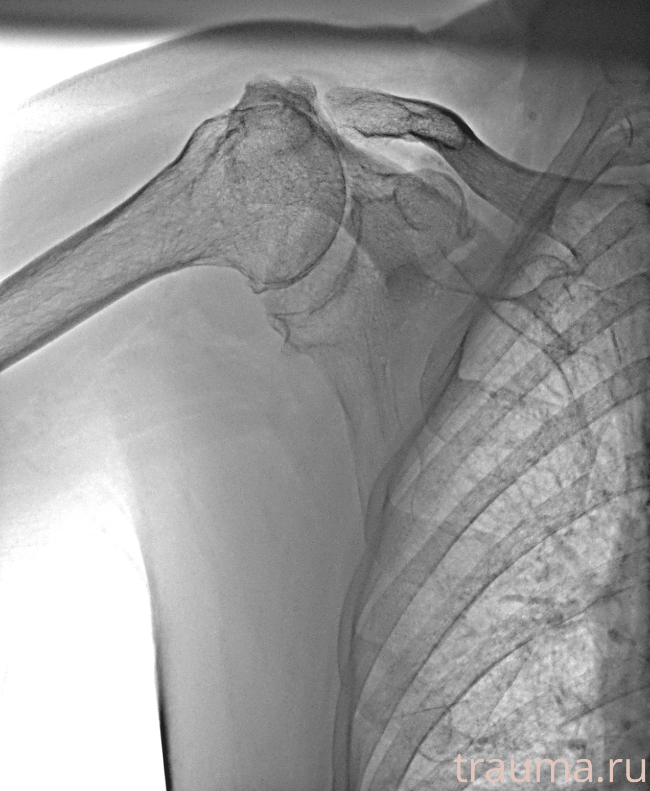 Рентген на дому: по вашему адресу приезжает врач-рентгенолог, травматолог-ортопед с мобильным рентгеновским аппаратом, проводит диагностику травмы или заболевания, делает необходимые рентгенограммы, дает рекомендации по дальнейшему лечению. Получить качественные снимки в домашних условиях возможно благодаря уникальной методике, разработанной МосРентген Центром для института  Склифосовского