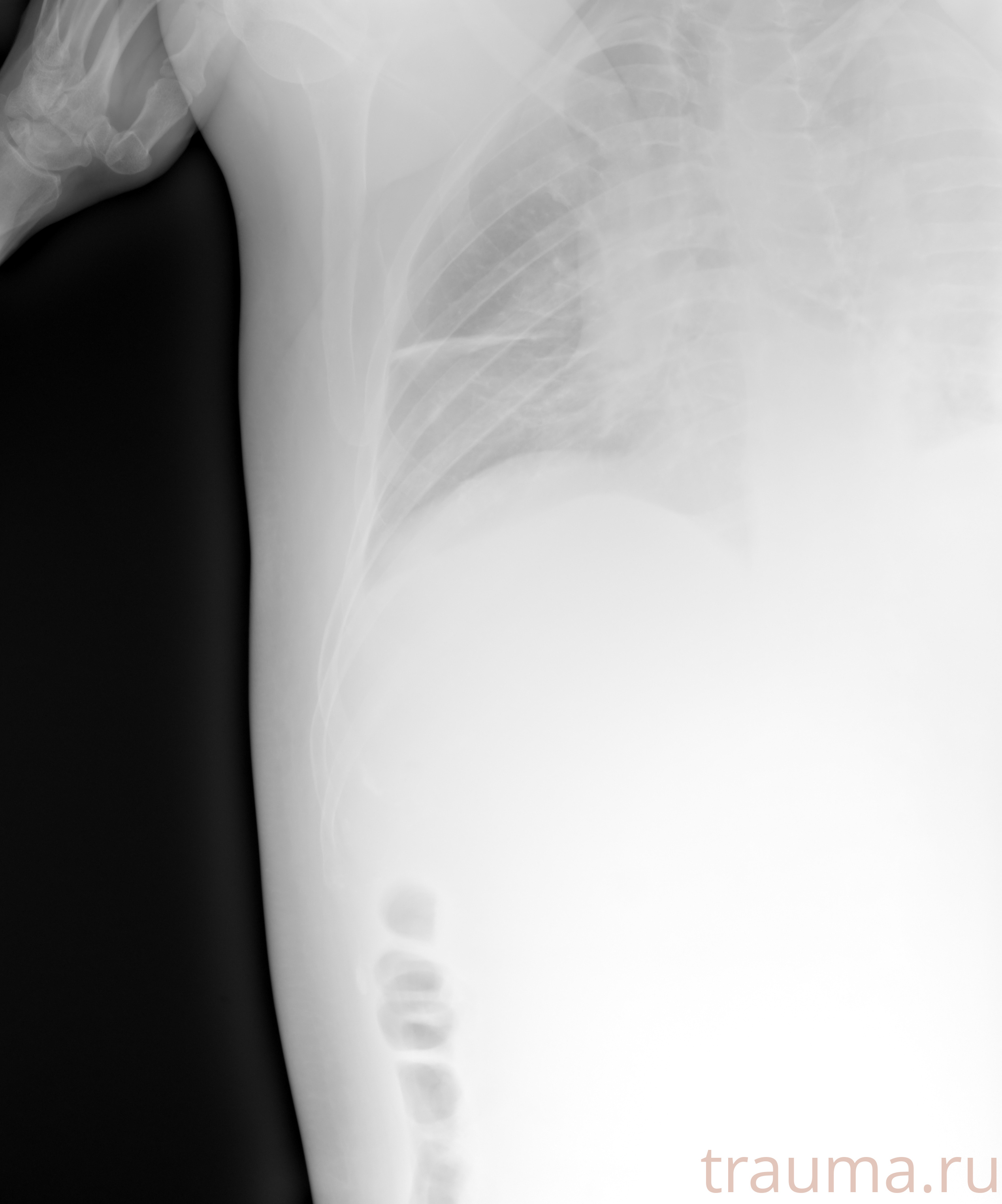 Рентген на дому: по вашему адресу приезжает врач-рентгенолог, травматолог-ортопед с мобильным рентгеновским аппаратом, проводит диагностику травмы или заболевания, делает необходимые рентгенограммы, дает рекомендации по дальнейшему лечению. Получить качественные снимки в домашних условиях возможно благодаря уникальной методике, разработанной МосРентген Центром для института  Склифосовского