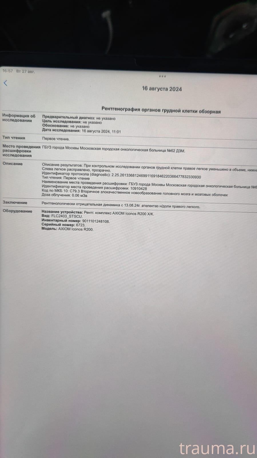 Рентген на дому: по вашему адресу приезжает врач-рентгенолог, травматолог-ортопед с мобильным рентгеновским аппаратом, проводит диагностику травмы или заболевания, делает необходимые рентгенограммы, дает рекомендации по дальнейшему лечению. Получить качественные снимки в домашних условиях возможно благодаря уникальной методике, разработанной МосРентген Центром для института  Склифосовского