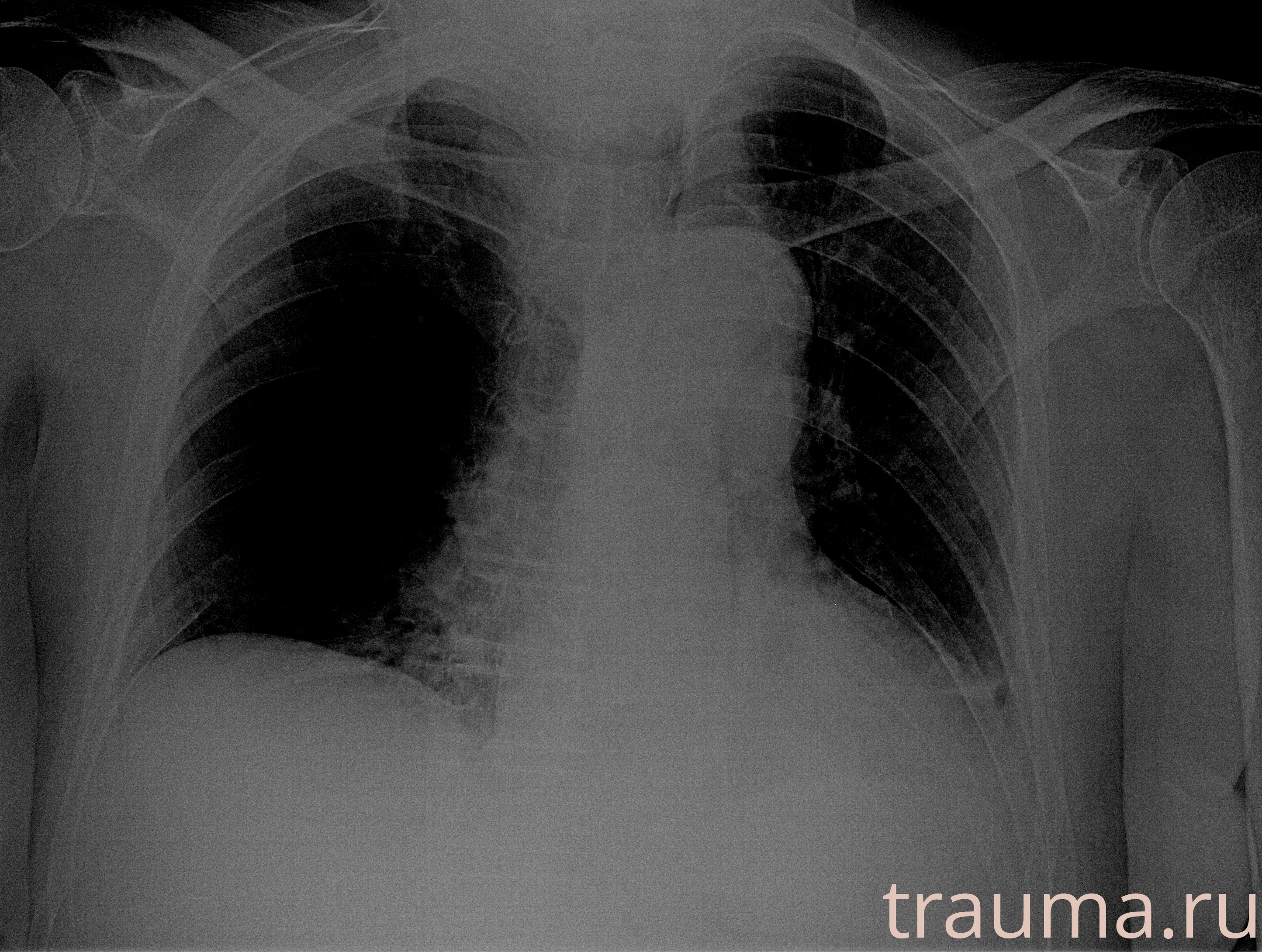 Рентген на дому: по вашему адресу приезжает врач-рентгенолог, травматолог-ортопед с мобильным рентгеновским аппаратом, проводит диагностику травмы или заболевания, делает необходимые рентгенограммы, дает рекомендации по дальнейшему лечению. Получить качественные снимки в домашних условиях возможно благодаря уникальной методике, разработанной МосРентген Центром для института  Склифосовского