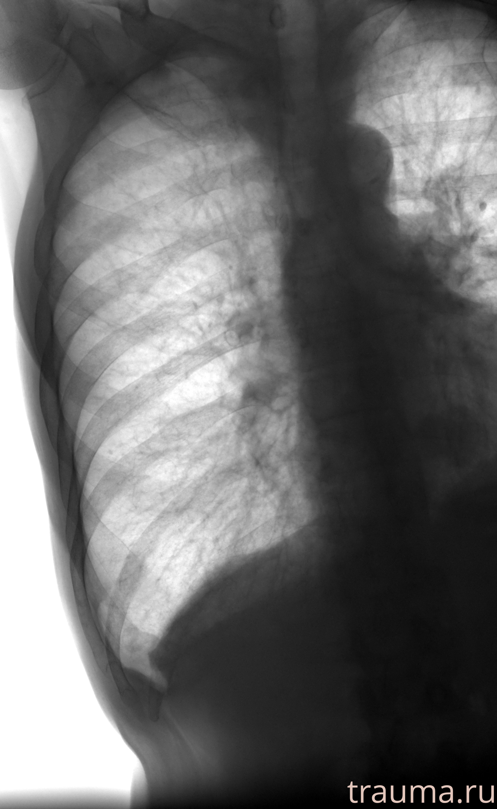 Рентген на дому: по вашему адресу приезжает врач-рентгенолог, травматолог-ортопед с мобильным рентгеновским аппаратом, проводит диагностику травмы или заболевания, делает необходимые рентгенограммы, дает рекомендации по дальнейшему лечению. Получить качественные снимки в домашних условиях возможно благодаря уникальной методике, разработанной МосРентген Центром для института  Склифосовского