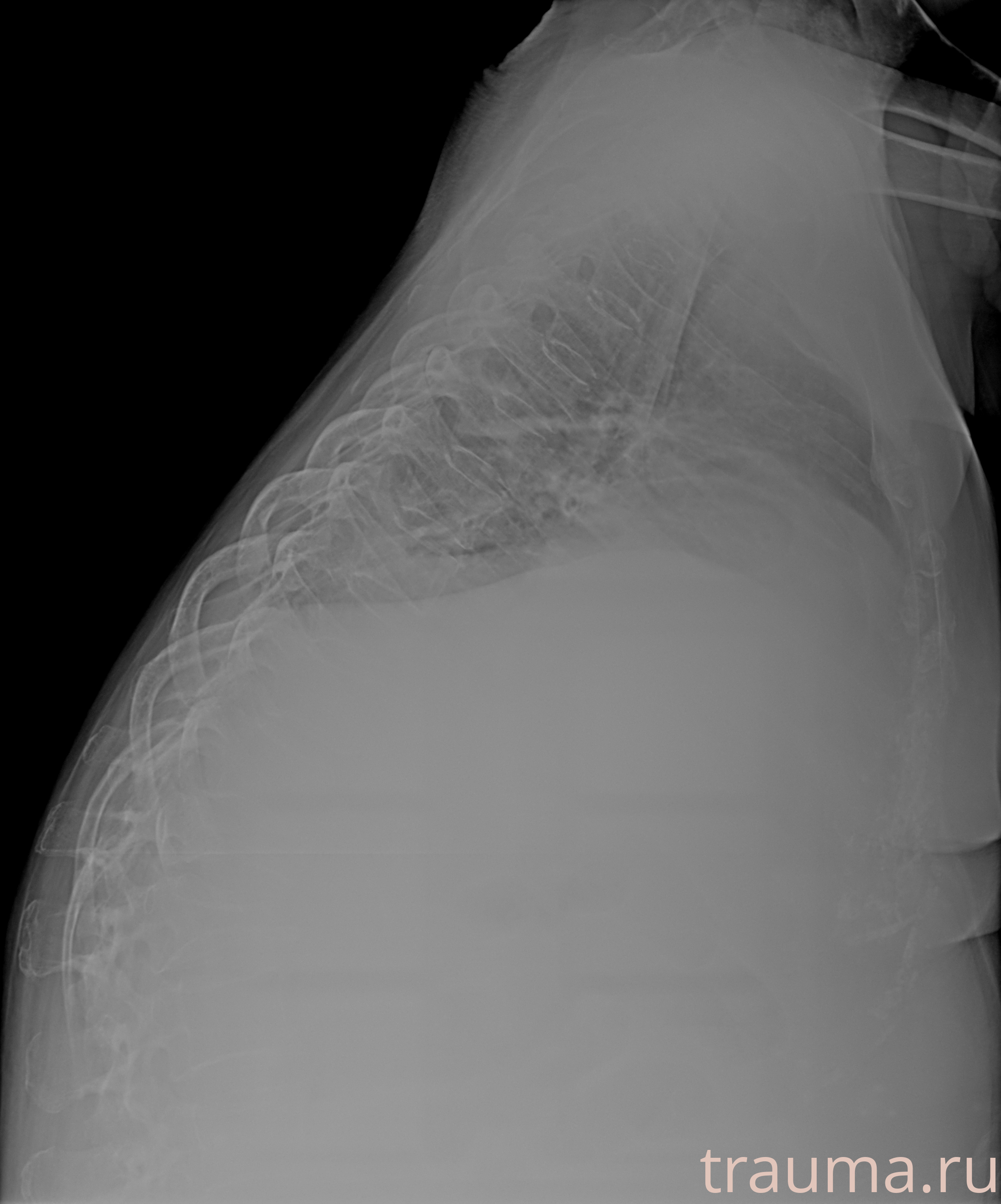 Рентген на дому: по вашему адресу приезжает врач-рентгенолог, травматолог-ортопед с мобильным рентгеновским аппаратом, проводит диагностику травмы или заболевания, делает необходимые рентгенограммы, дает рекомендации по дальнейшему лечению. Получить качественные снимки в домашних условиях возможно благодаря уникальной методике, разработанной МосРентген Центром для института  Склифосовского