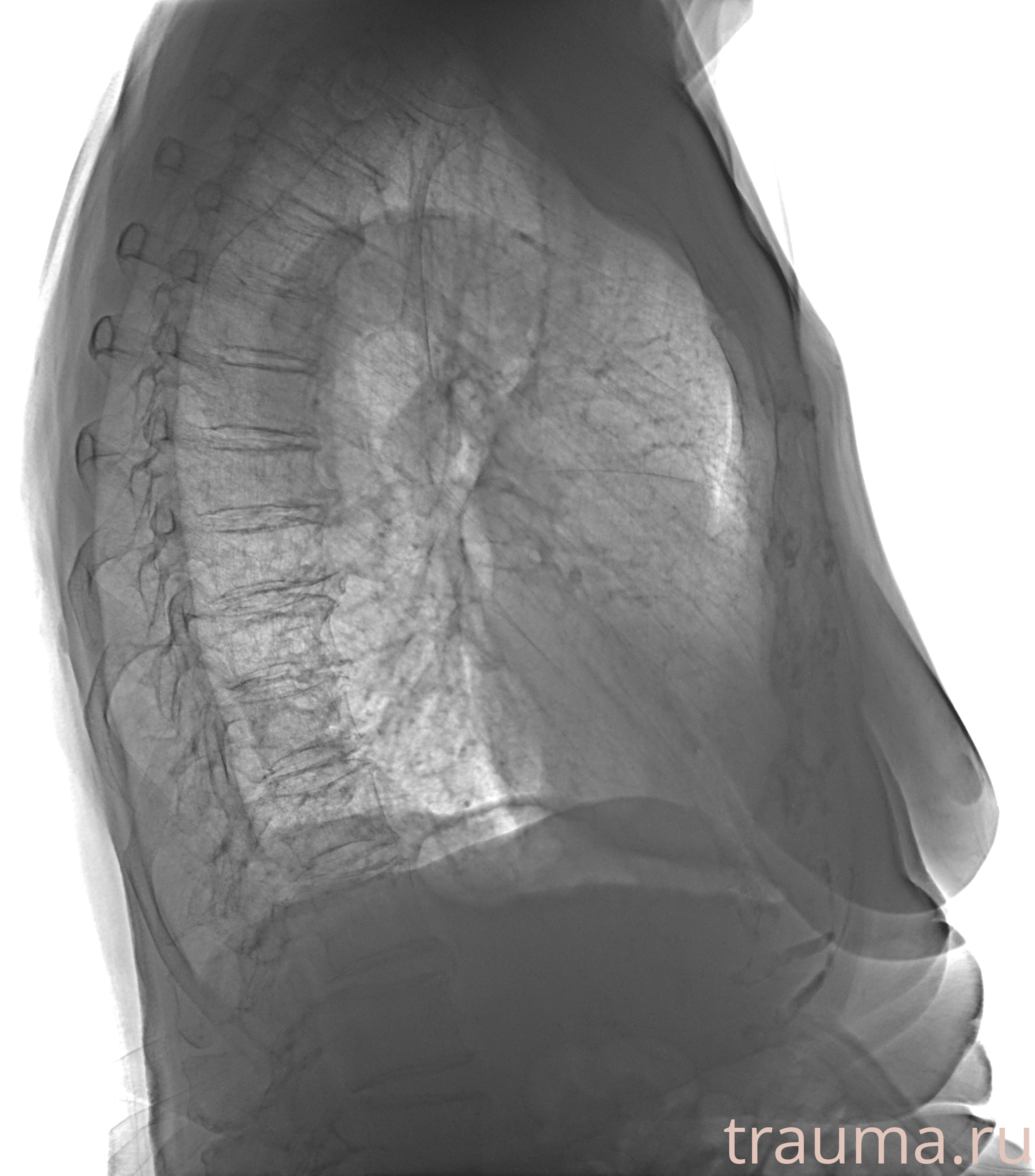 Рентген на дому: по вашему адресу приезжает врач-рентгенолог, травматолог-ортопед с мобильным рентгеновским аппаратом, проводит диагностику травмы или заболевания, делает необходимые рентгенограммы, дает рекомендации по дальнейшему лечению. Получить качественные снимки в домашних условиях возможно благодаря уникальной методике, разработанной МосРентген Центром для института  Склифосовского