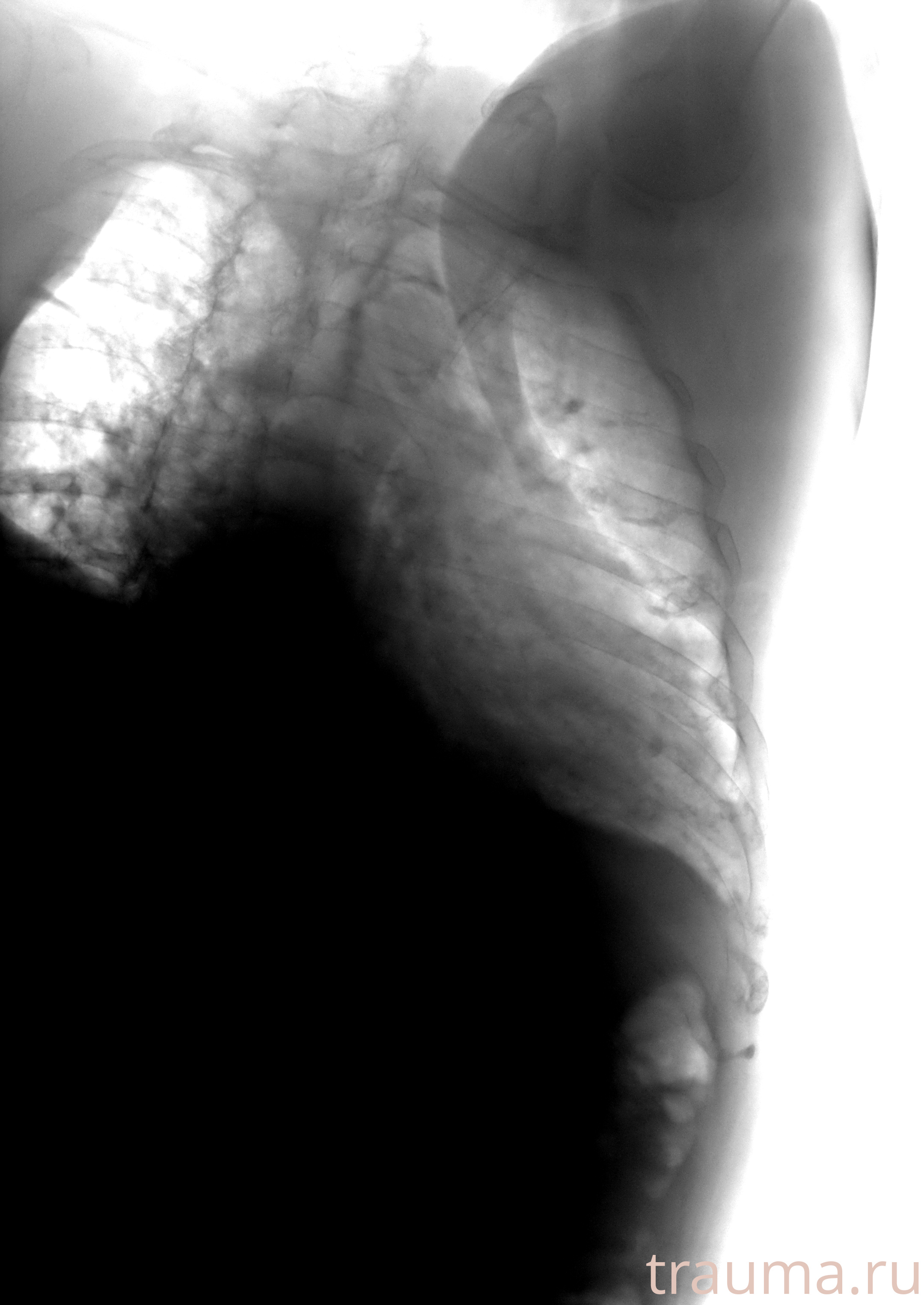 Рентген на дому: по вашему адресу приезжает врач-рентгенолог, травматолог-ортопед с мобильным рентгеновским аппаратом, проводит диагностику травмы или заболевания, делает необходимые рентгенограммы, дает рекомендации по дальнейшему лечению. Получить качественные снимки в домашних условиях возможно благодаря уникальной методике, разработанной МосРентген Центром для института  Склифосовского