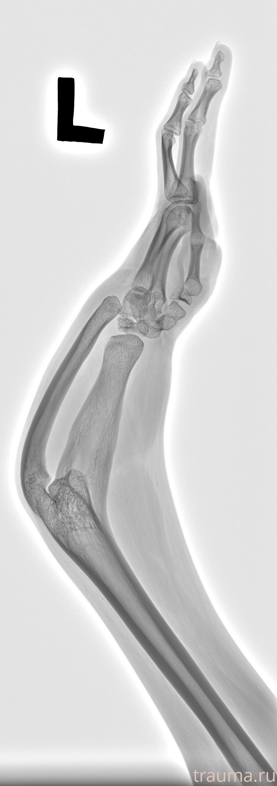 Рентген на дому: по вашему адресу приезжает врач-рентгенолог, травматолог-ортопед с мобильным рентгеновским аппаратом, проводит диагностику травмы или заболевания, делает необходимые рентгенограммы, дает рекомендации по дальнейшему лечению. Получить качественные снимки в домашних условиях возможно благодаря уникальной методике, разработанной МосРентген Центром для института  Склифосовского