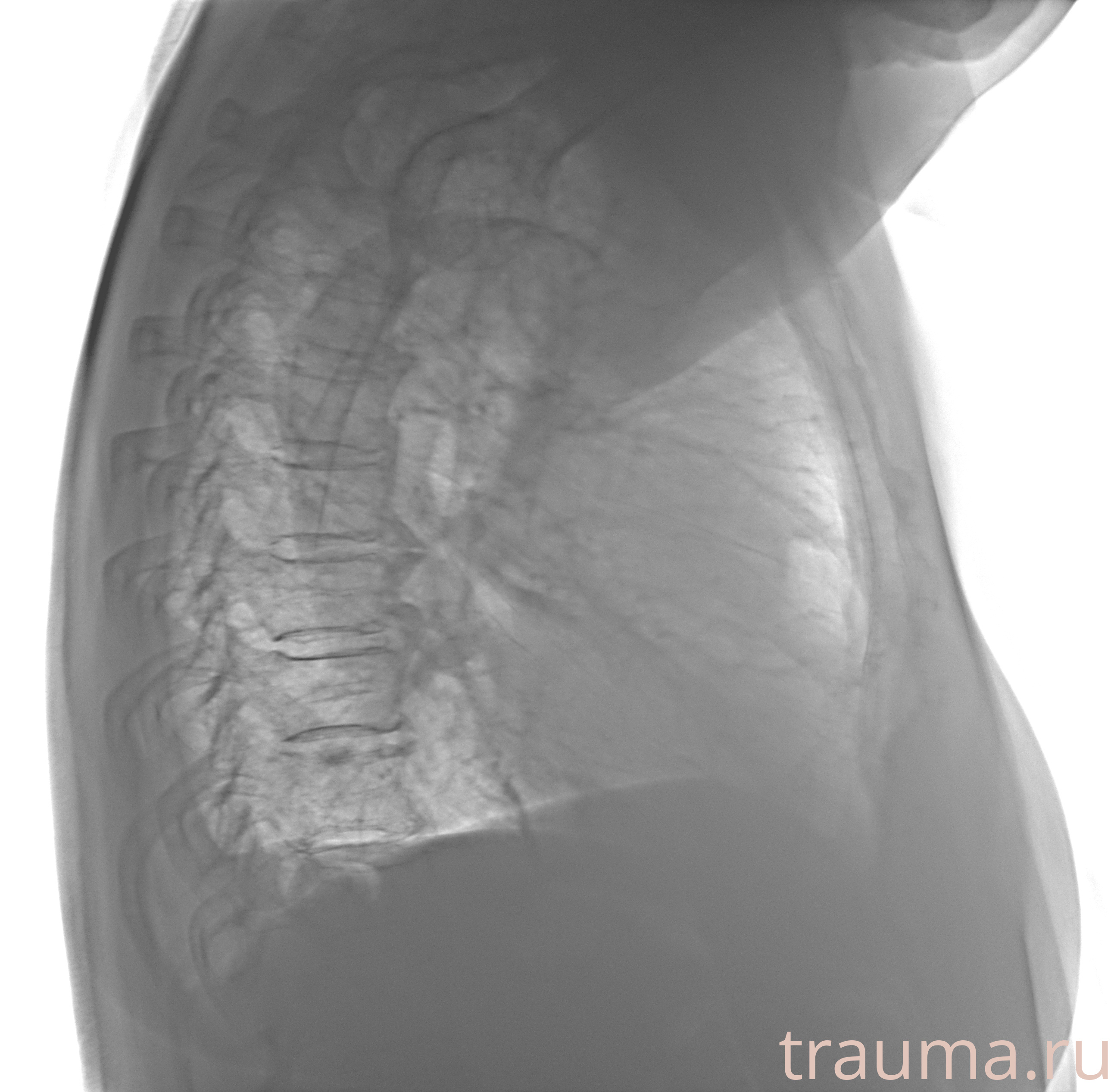 Рентген на дому: по вашему адресу приезжает врач-рентгенолог, травматолог-ортопед с мобильным рентгеновским аппаратом, проводит диагностику травмы или заболевания, делает необходимые рентгенограммы, дает рекомендации по дальнейшему лечению. Получить качественные снимки в домашних условиях возможно благодаря уникальной методике, разработанной МосРентген Центром для института  Склифосовского