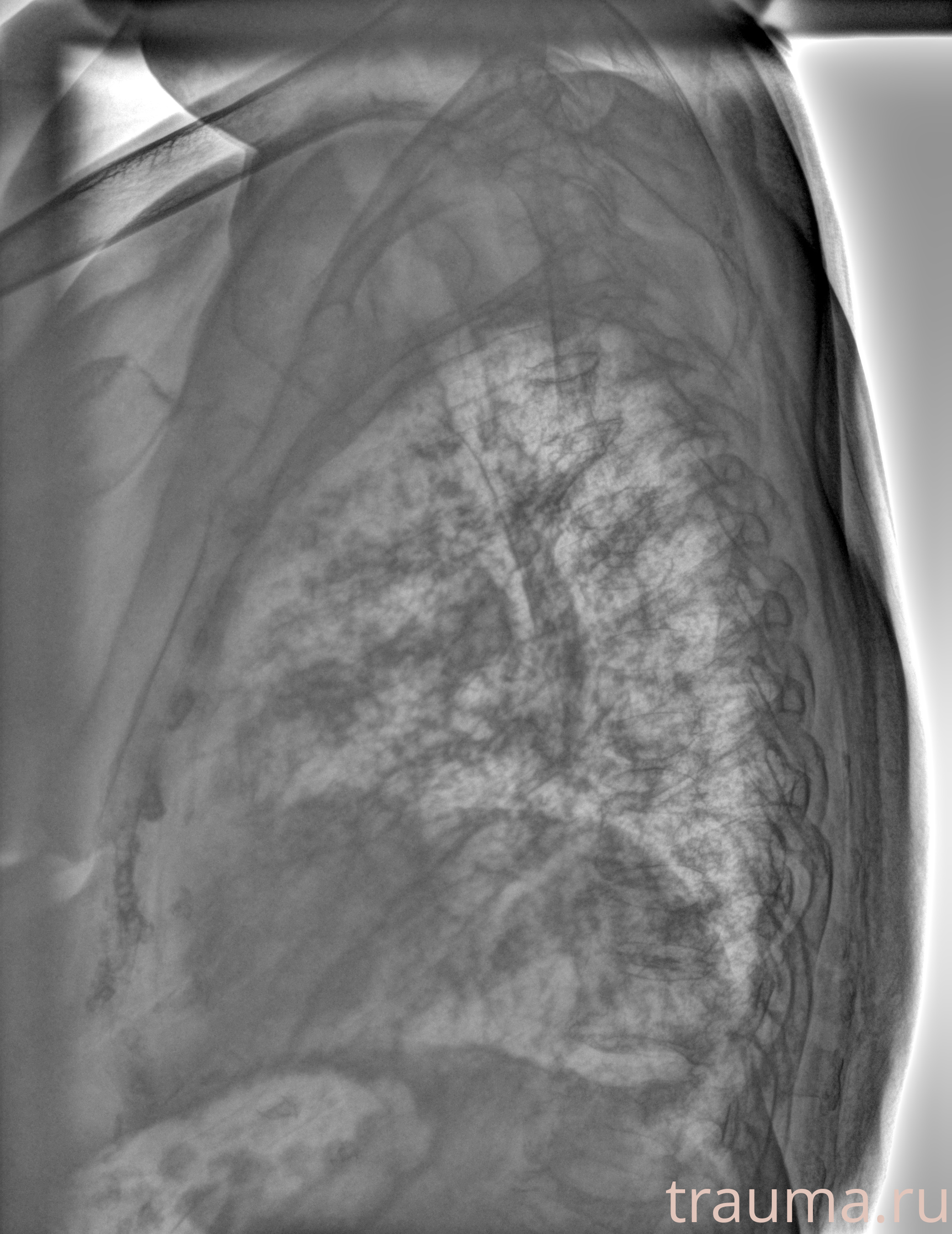 Рентген на дому: по вашему адресу приезжает врач-рентгенолог, травматолог-ортопед с мобильным рентгеновским аппаратом, проводит диагностику травмы или заболевания, делает необходимые рентгенограммы, дает рекомендации по дальнейшему лечению. Получить качественные снимки в домашних условиях возможно благодаря уникальной методике, разработанной МосРентген Центром для института  Склифосовского