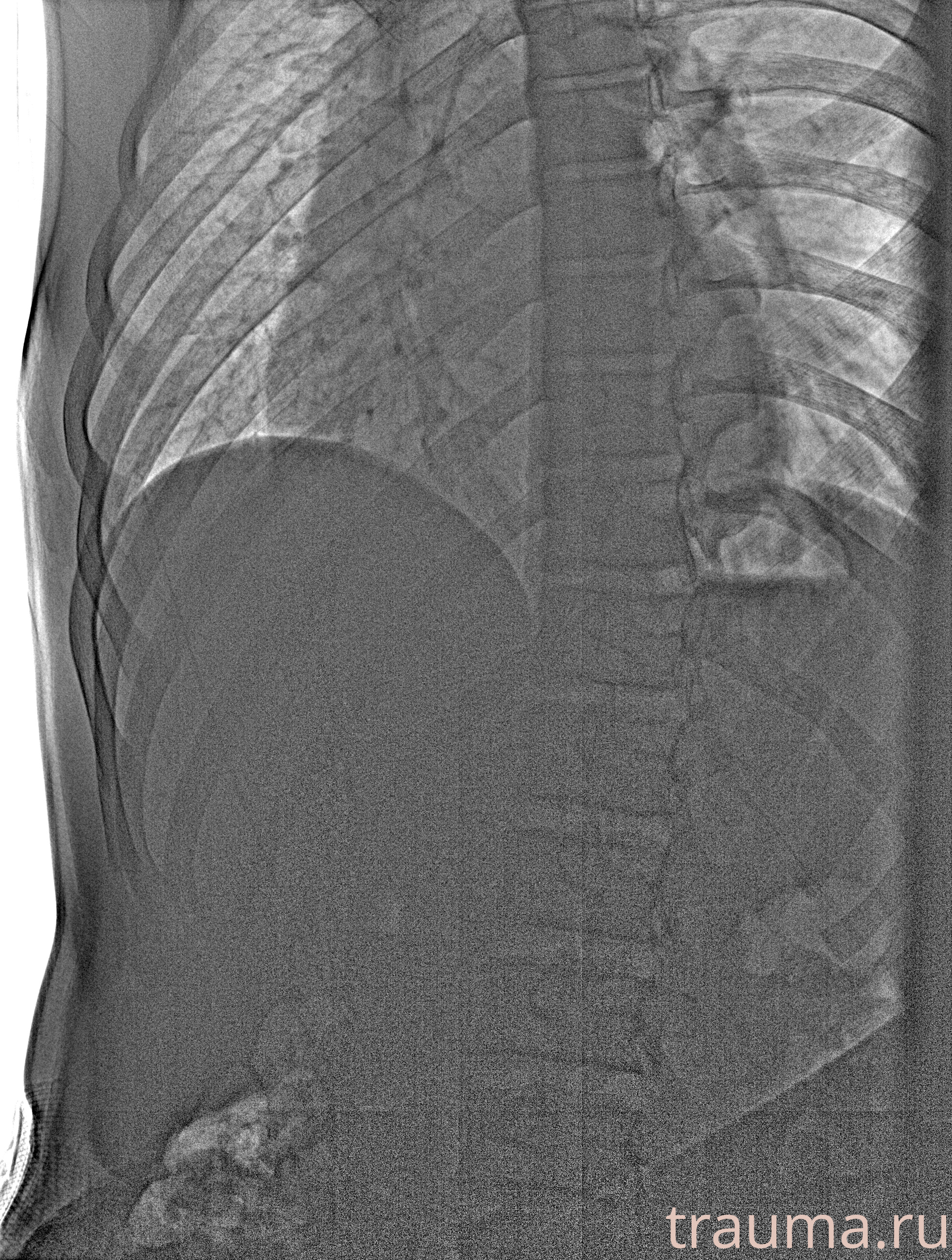 Рентген на дому: по вашему адресу приезжает врач-рентгенолог, травматолог-ортопед с мобильным рентгеновским аппаратом, проводит диагностику травмы или заболевания, делает необходимые рентгенограммы, дает рекомендации по дальнейшему лечению. Получить качественные снимки в домашних условиях возможно благодаря уникальной методике, разработанной МосРентген Центром для института  Склифосовского