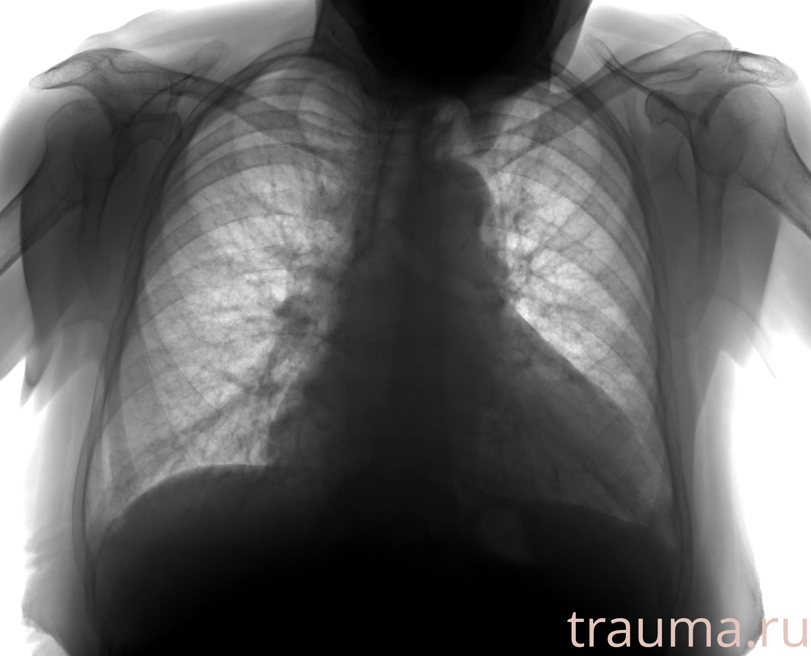 Рентген на дому: по вашему адресу приезжает врач-рентгенолог, травматолог-ортопед с мобильным рентгеновским аппаратом, проводит диагностику травмы или заболевания, делает необходимые рентгенограммы, дает рекомендации по дальнейшему лечению. Получить качественные снимки в домашних условиях возможно благодаря уникальной методике, разработанной МосРентген Центром для института  Склифосовского