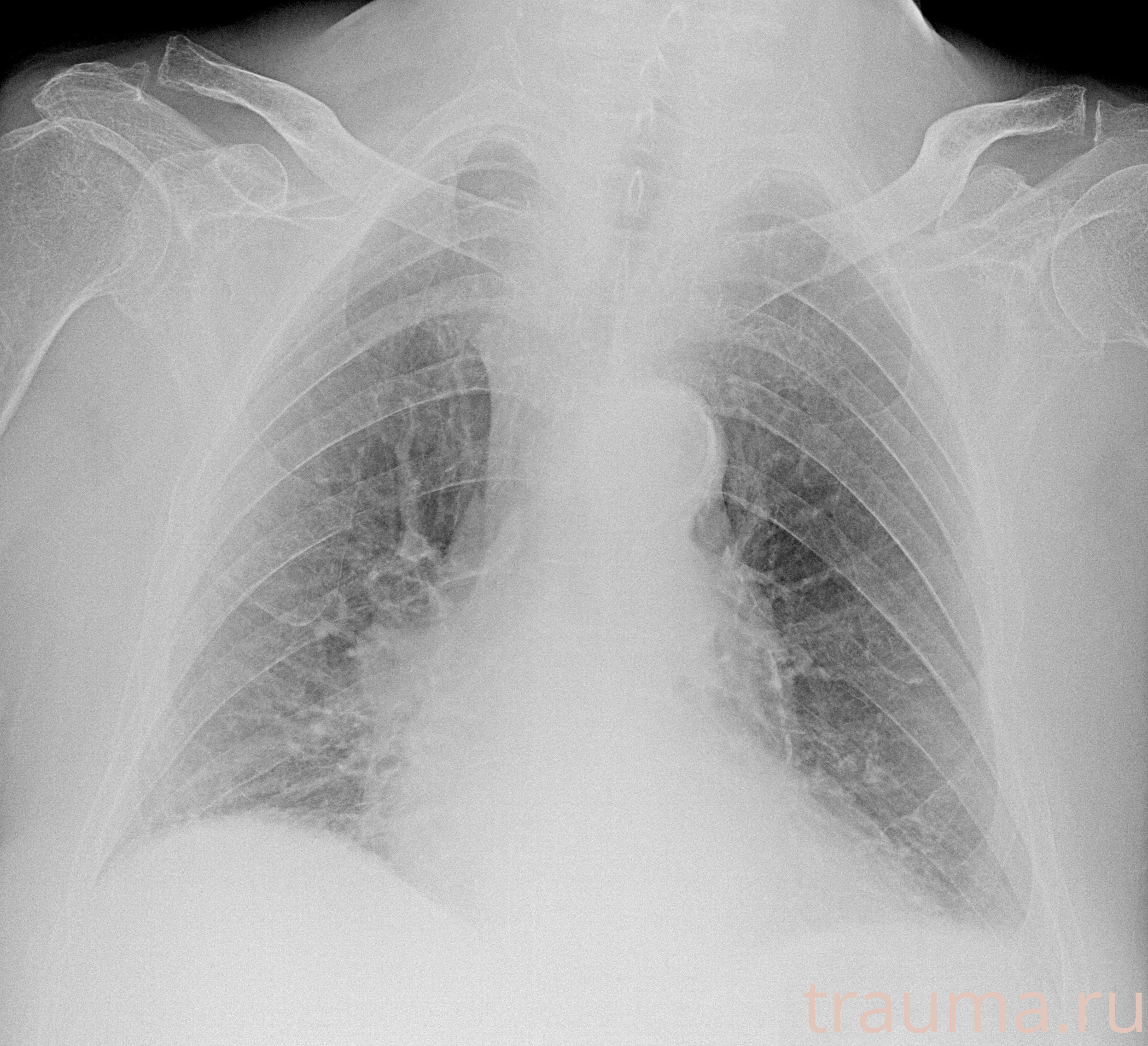 Рентген на дому: по вашему адресу приезжает врач-рентгенолог, травматолог-ортопед с мобильным рентгеновским аппаратом, проводит диагностику травмы или заболевания, делает необходимые рентгенограммы, дает рекомендации по дальнейшему лечению. Получить качественные снимки в домашних условиях возможно благодаря уникальной методике, разработанной МосРентген Центром для института  Склифосовского