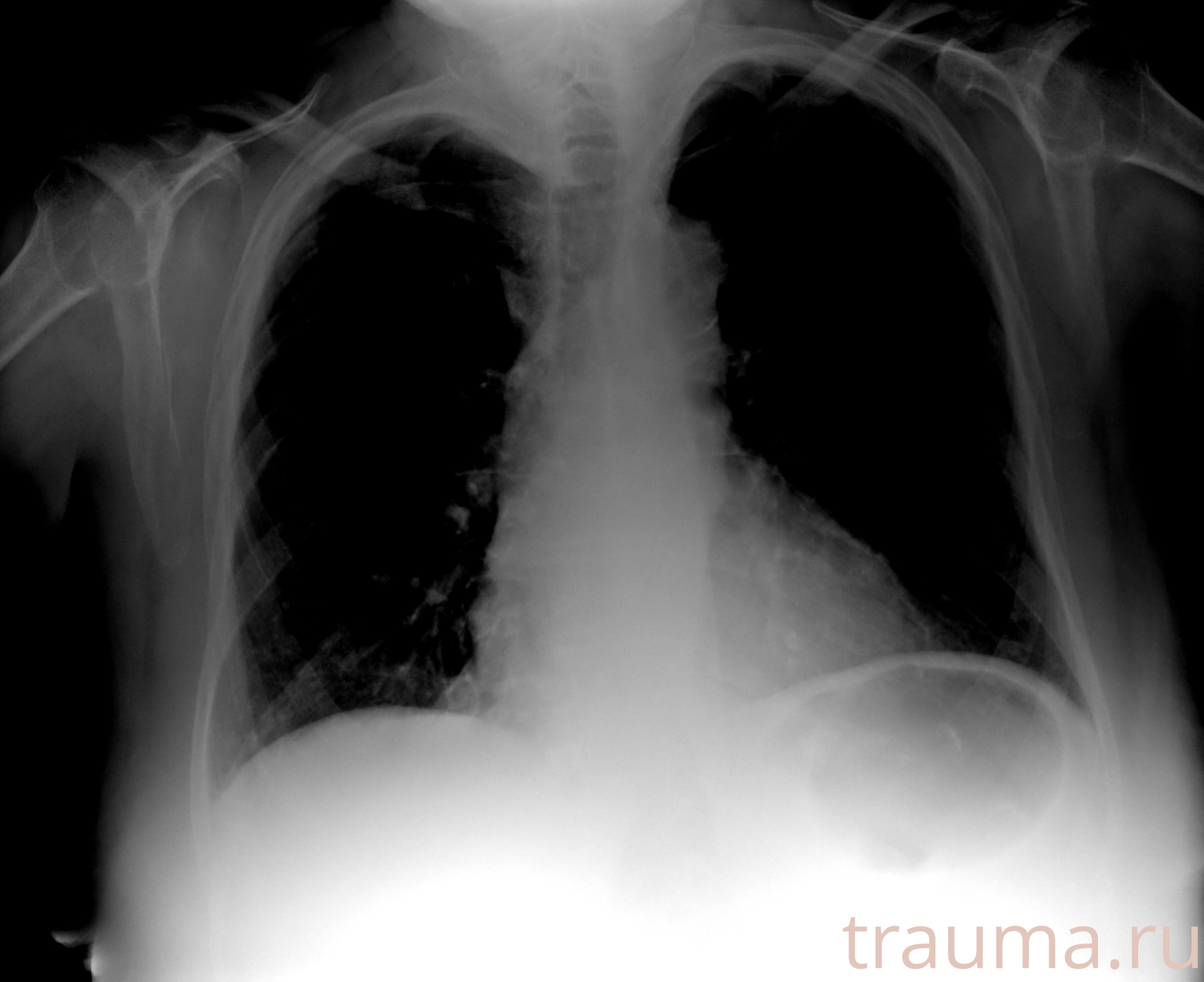 Рентген на дому: по вашему адресу приезжает врач-рентгенолог, травматолог-ортопед с мобильным рентгеновским аппаратом, проводит диагностику травмы или заболевания, делает необходимые рентгенограммы, дает рекомендации по дальнейшему лечению. Получить качественные снимки в домашних условиях возможно благодаря уникальной методике, разработанной МосРентген Центром для института  Склифосовского