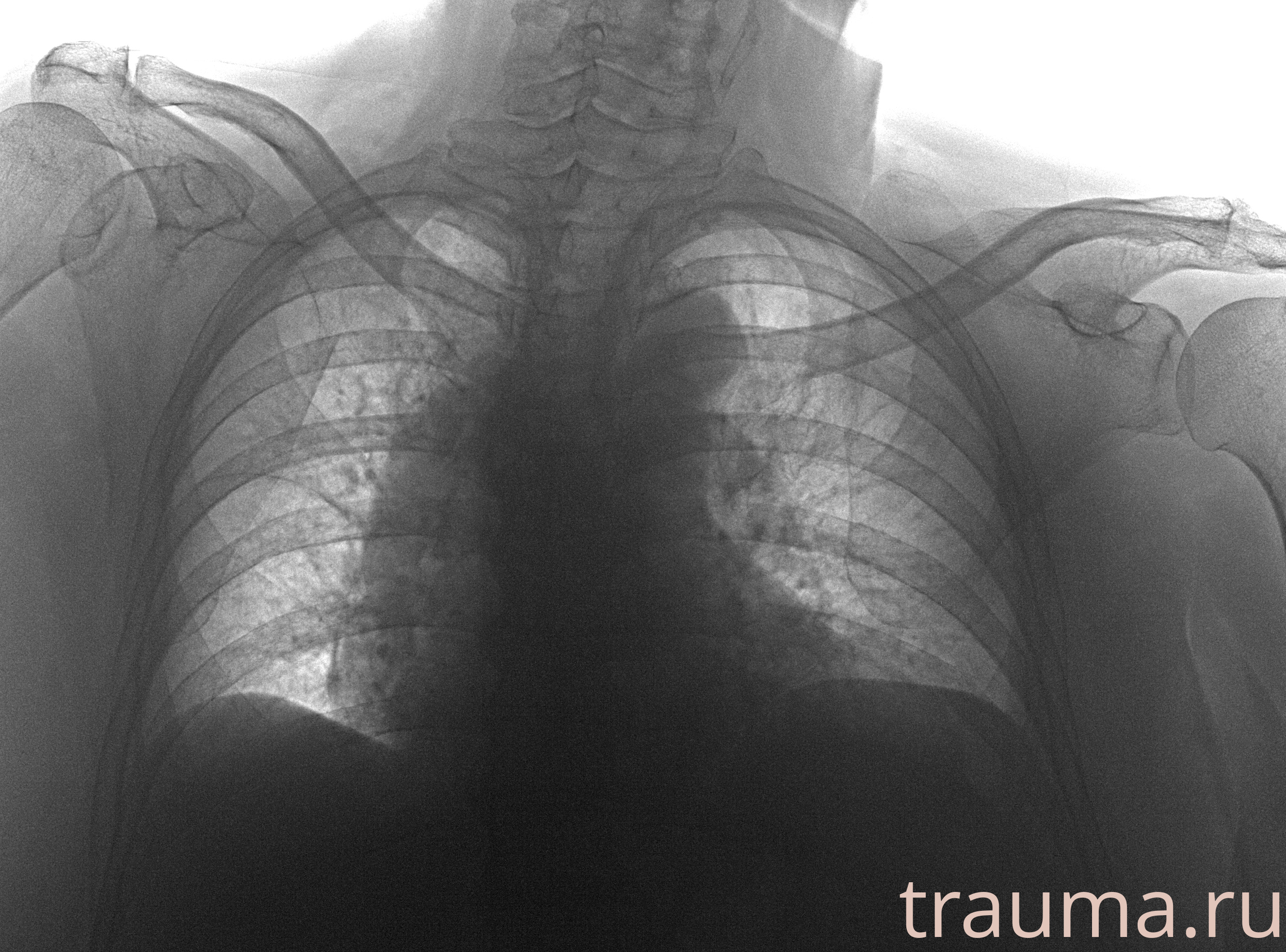 Рентген на дому: по вашему адресу приезжает врач-рентгенолог, травматолог-ортопед с мобильным рентгеновским аппаратом, проводит диагностику травмы или заболевания, делает необходимые рентгенограммы, дает рекомендации по дальнейшему лечению. Получить качественные снимки в домашних условиях возможно благодаря уникальной методике, разработанной МосРентген Центром для института  Склифосовского