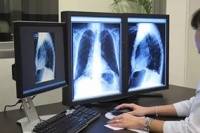 Качественные и количественные показатели
рентгенологической оценки дистракционного регенерата Качественные и количественные показатели
рентгенологической оценки дистракционного регенерата