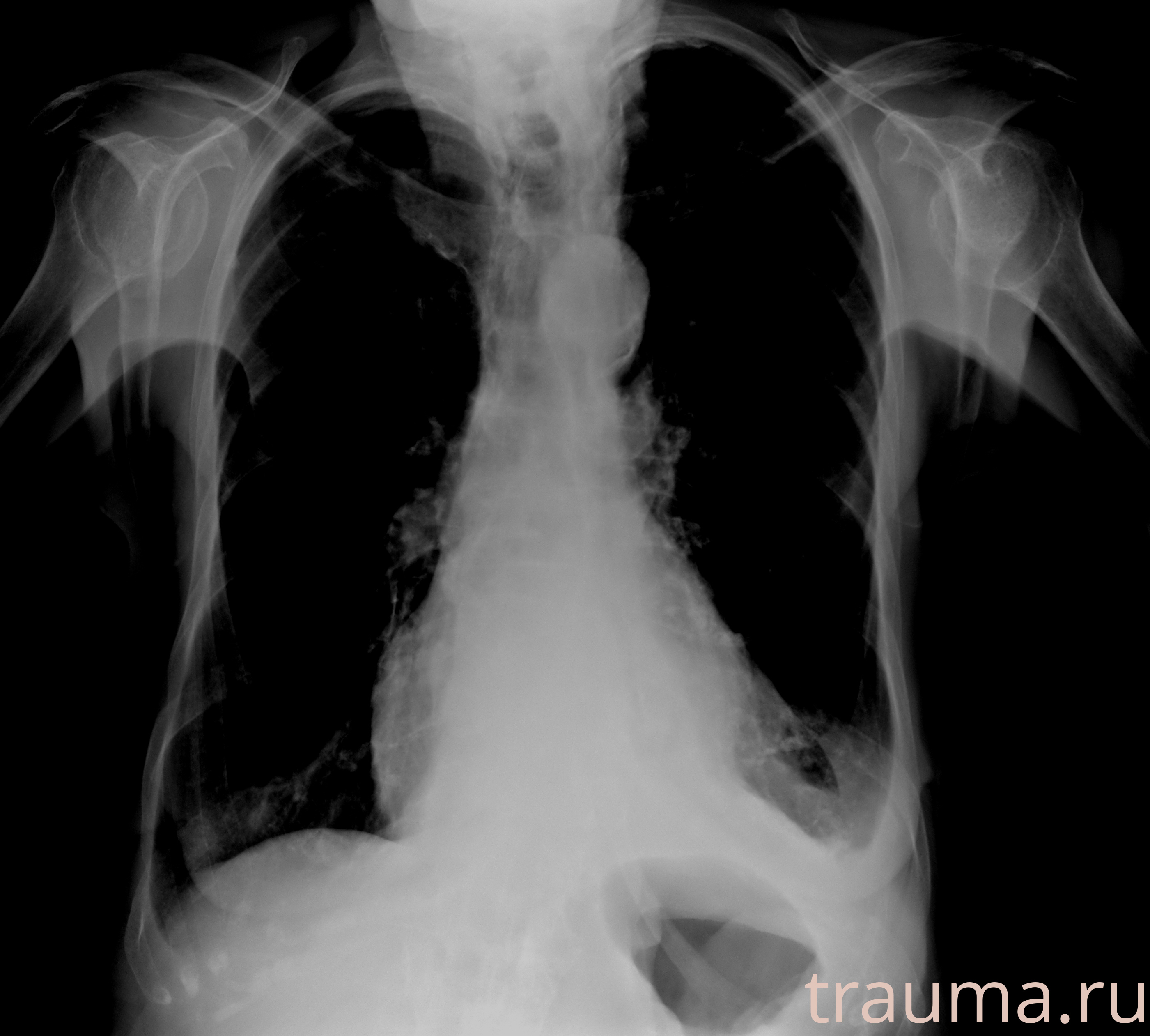 Рентген на дому: по вашему адресу приезжает врач-рентгенолог, травматолог-ортопед с мобильным рентгеновским аппаратом, проводит диагностику травмы или заболевания, делает необходимые рентгенограммы, дает рекомендации по дальнейшему лечению. Получить качественные снимки в домашних условиях возможно благодаря уникальной методике, разработанной МосРентген Центром для института  Склифосовского