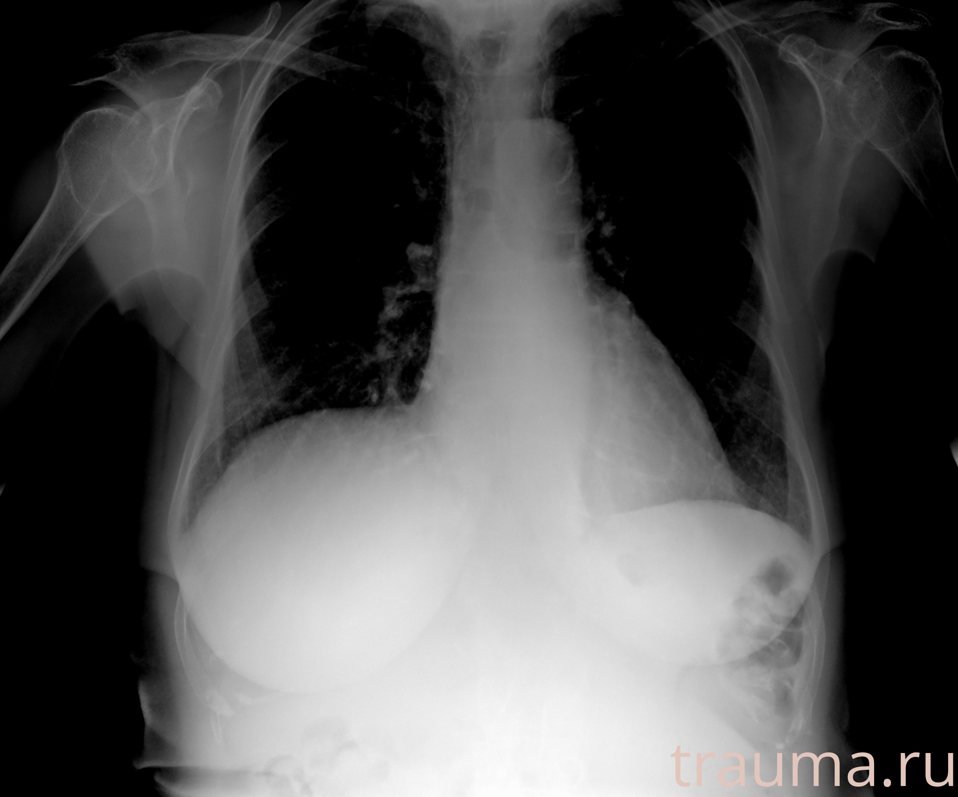 Рентген на дому: по вашему адресу приезжает врач-рентгенолог, травматолог-ортопед с мобильным рентгеновским аппаратом, проводит диагностику травмы или заболевания, делает необходимые рентгенограммы, дает рекомендации по дальнейшему лечению. Получить качественные снимки в домашних условиях возможно благодаря уникальной методике, разработанной МосРентген Центром для института  Склифосовского